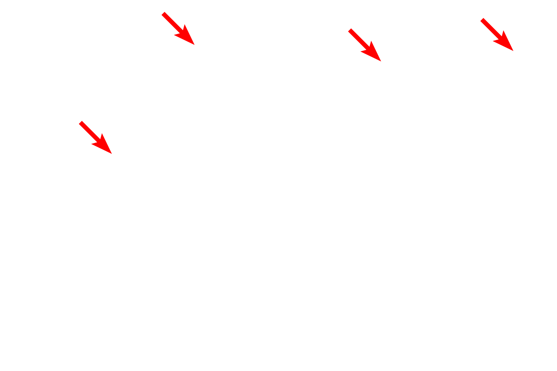  - Sheet gland <p>A trichrome stain demonstrates the pyloric mucosa.  Deep, wide gastric pits, interconnecting the surface with the pyloric glands, are longer than the glands.  Pyloric glands possess mostly mucus-secreting cells and are quite tortuous, so that they are cut in multiple planes when sectioned.  100x</p>
