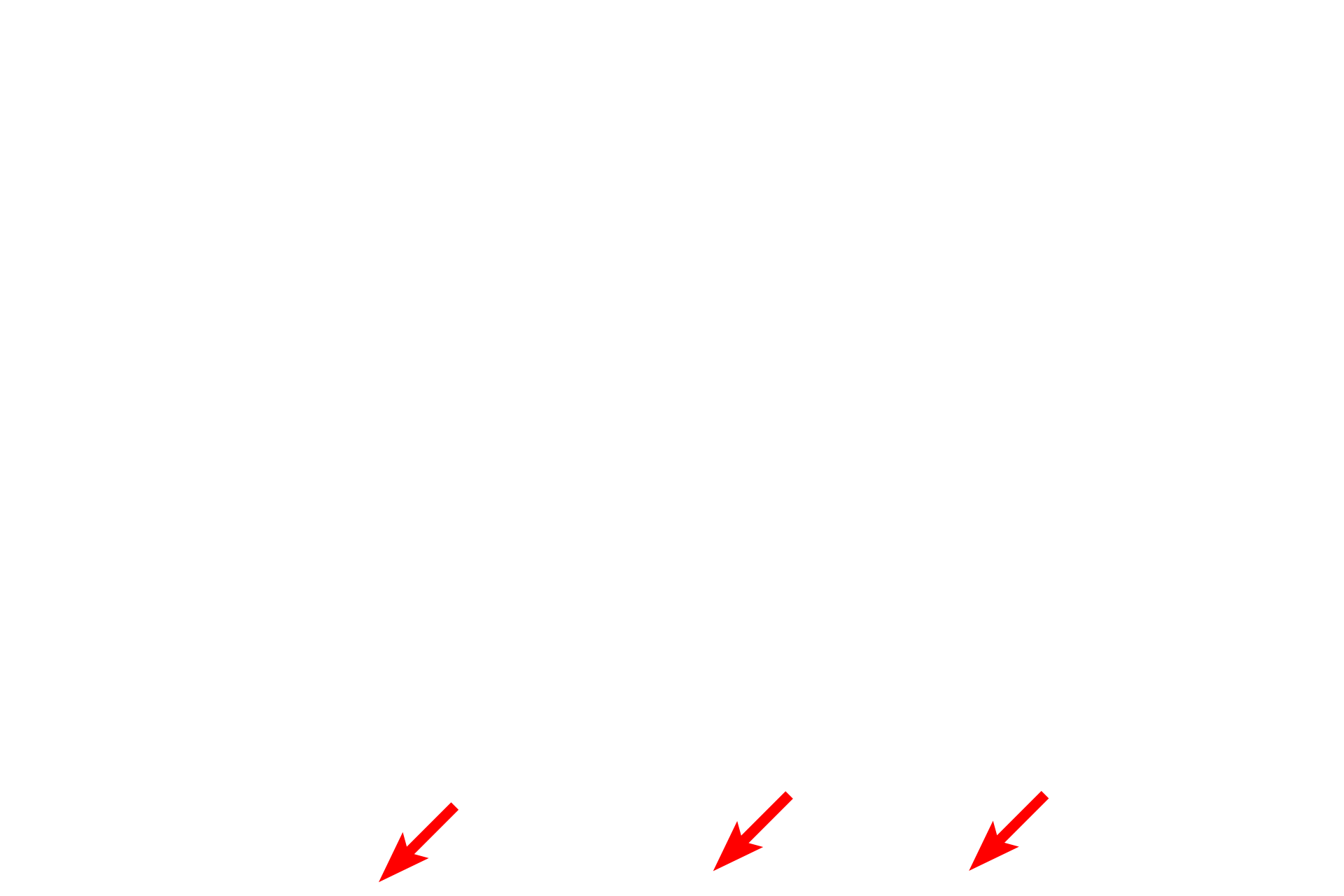 Submucosa <p>A trichrome stain demonstrates the pyloric mucosa.  Deep, wide gastric pits, interconnecting the surface with the pyloric glands, are longer than the glands.  Pyloric glands possess mostly mucus-secreting cells and are quite tortuous, so that they are cut in multiple planes when sectioned.  100x</p>
