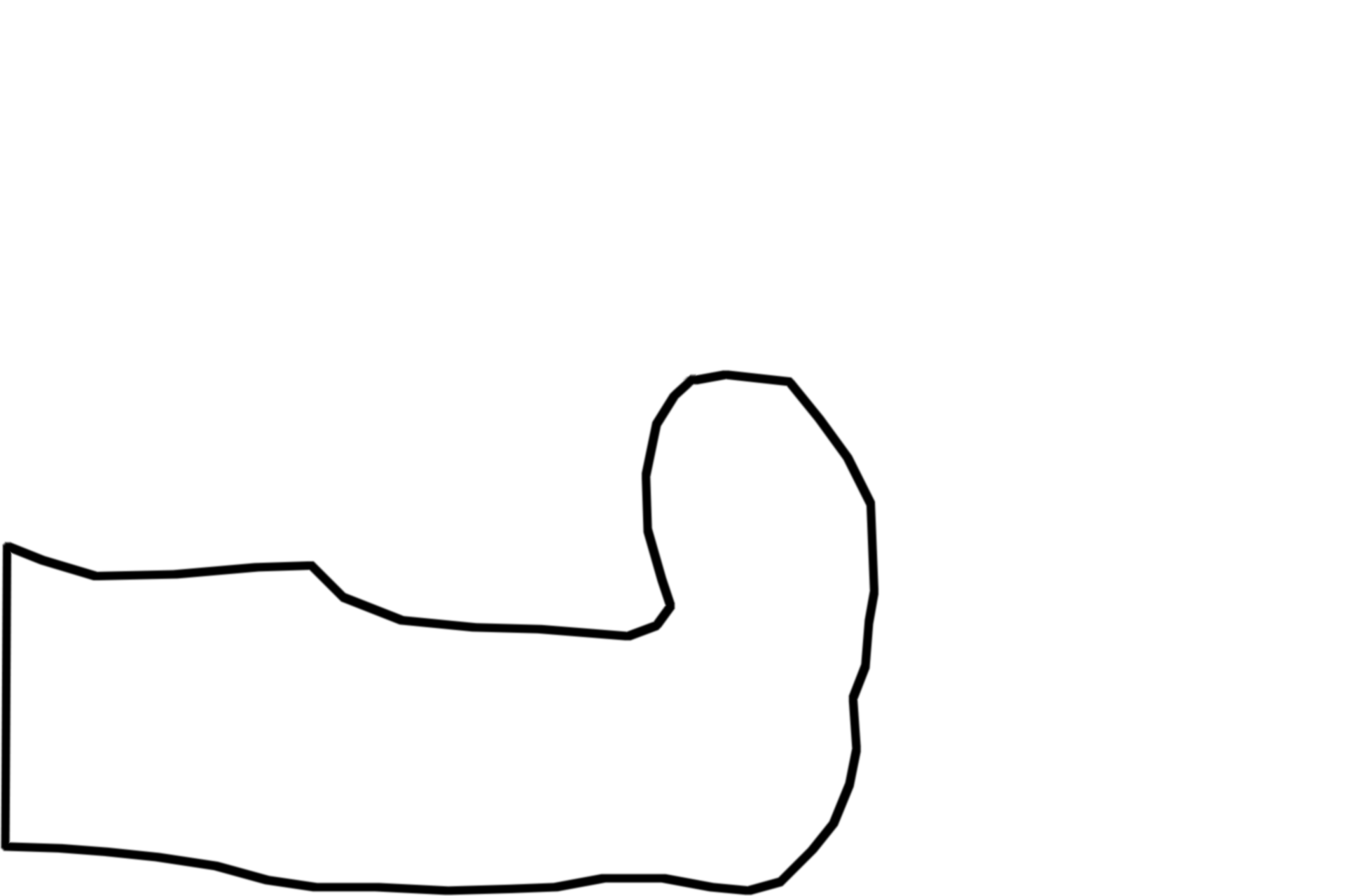Duodenum <p>Several criteria differentiate the transition of pyloric stomach to the duodenum of the small intestine.  As denoted by their names, gastric pits and gastric glands occur only in stomach.  Villi, intestinal glands, and submucosal glands (also called Brunner’s glands) distinguish the duodenum.  The inner circular layer of muscularis externa in the stomach is modified to form the pyloric sphincter.  10x</p>
