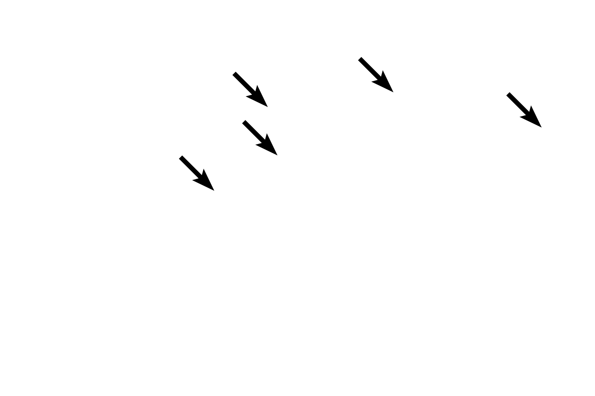  - Pyloric glands <p>Several criteria differentiate the transition of pyloric stomach to the duodenum of the small intestine.  As denoted by their names, gastric pits and gastric glands occur only in stomach.  Villi, intestinal glands, and submucosal glands (also called Brunner’s glands) distinguish the duodenum.  The inner circular layer of muscularis externa in the stomach is modified to form the pyloric sphincter.  10x</p>
