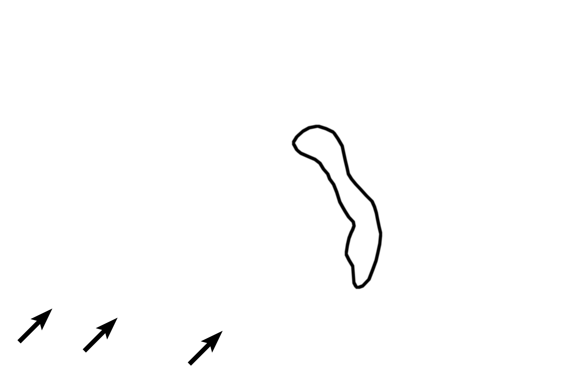  - Brunner's glands (submucosal glands) <p>Several criteria differentiate the transition of pyloric stomach to the duodenum of the small intestine.  As denoted by their names, gastric pits and gastric glands occur only in stomach.  Villi, intestinal glands, and submucosal glands (also called Brunner’s glands) distinguish the duodenum.  The inner circular layer of muscularis externa in the stomach is modified to form the pyloric sphincter.  10x</p>
