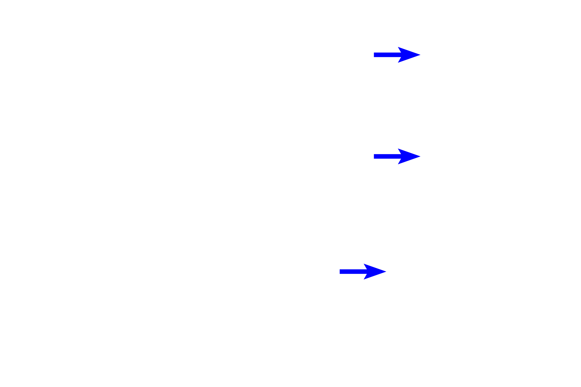  - Sheet gland <p>At the gastro-duodenal junction, the mucus-secreting, simple columnar epithelium (sheet gland) of the pylorus changes to a simple columnar epithelium of absorptive cells (enterocytes) and goblet cells in the duodenum.  Additionally, the duodenum can be differentiated by its villi and by submucosal gland (Brunner’s glands) in the submucosa.  100x</p>
