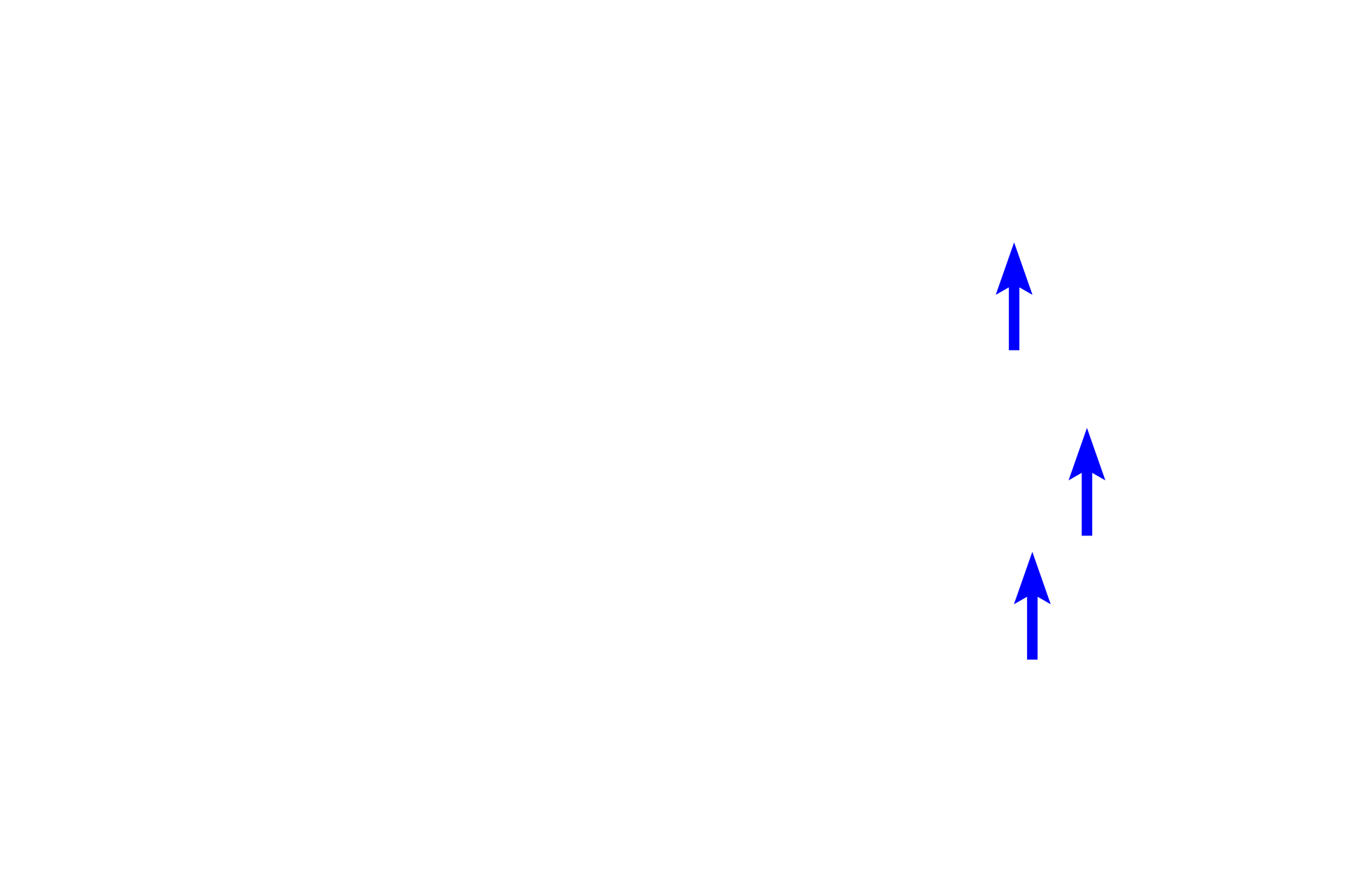  - Gastric pits <p>At the gastro-duodenal junction, the mucus-secreting, simple columnar epithelium (sheet gland) of the pylorus changes to a simple columnar epithelium of absorptive cells (enterocytes) and goblet cells in the duodenum.  Additionally, the duodenum can be differentiated by its villi and by submucosal gland (Brunner’s glands) in the submucosa.  100x</p>
