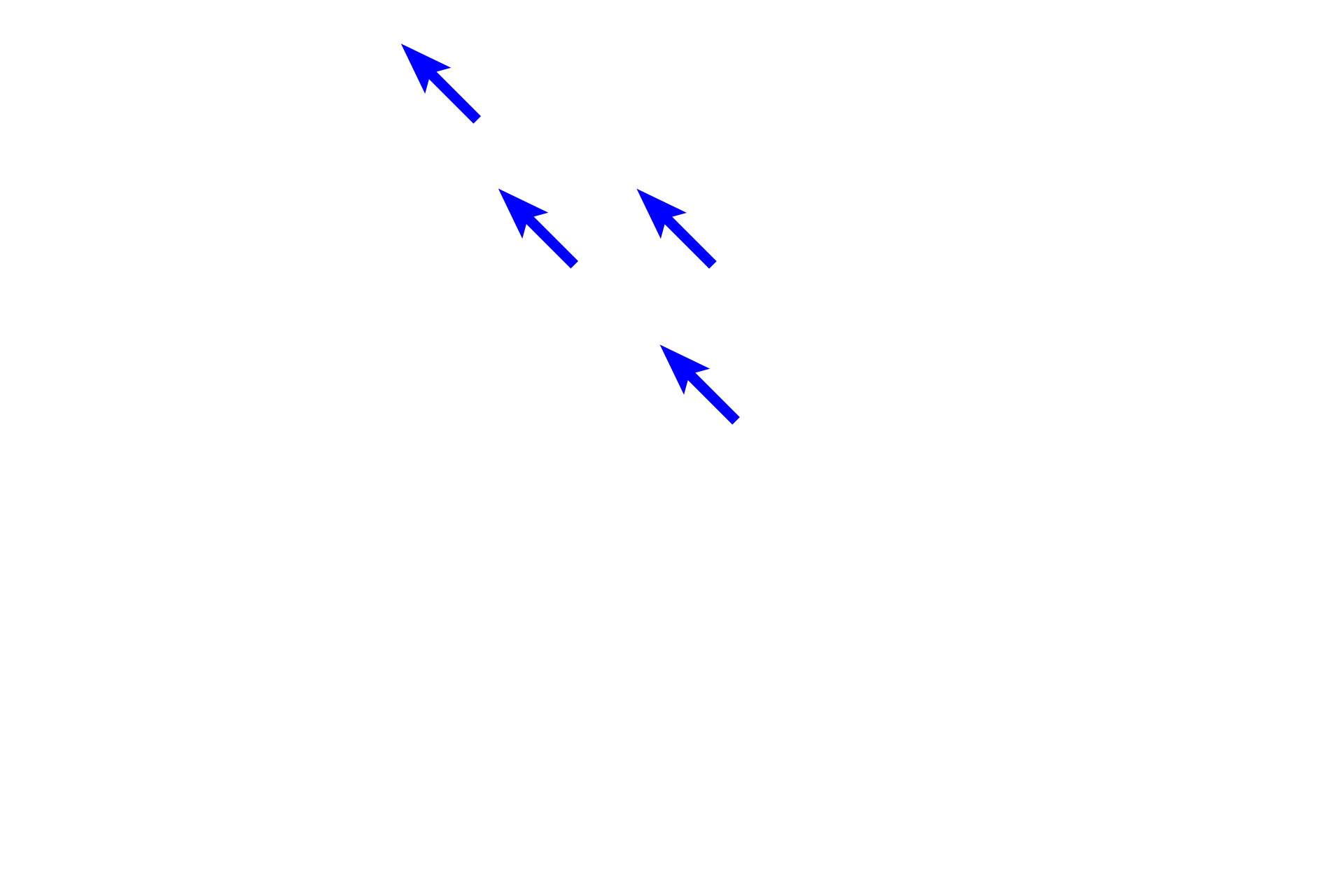  - Villi <p>At the gastro-duodenal junction, the mucus-secreting, simple columnar epithelium (sheet gland) of the pylorus changes to a simple columnar epithelium of absorptive cells (enterocytes) and goblet cells in the duodenum.  Additionally, the duodenum can be differentiated by its villi and by submucosal gland (Brunner’s glands) in the submucosa.  100x</p>
