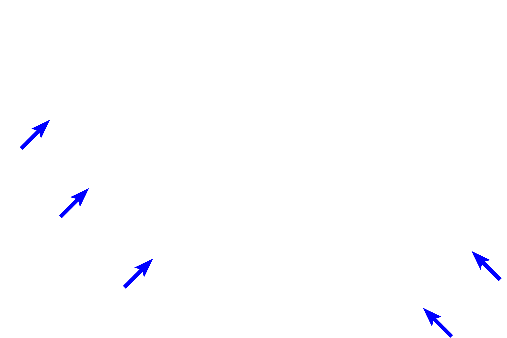 Muscularis mucosae <p>At the gastro-duodenal junction, the mucus-secreting, simple columnar epithelium (sheet gland) of the pylorus changes to a simple columnar epithelium of absorptive cells (enterocytes) and goblet cells in the duodenum.  Additionally, the duodenum can be differentiated by its villi and by submucosal gland (Brunner’s glands) in the submucosa.  100x</p>
