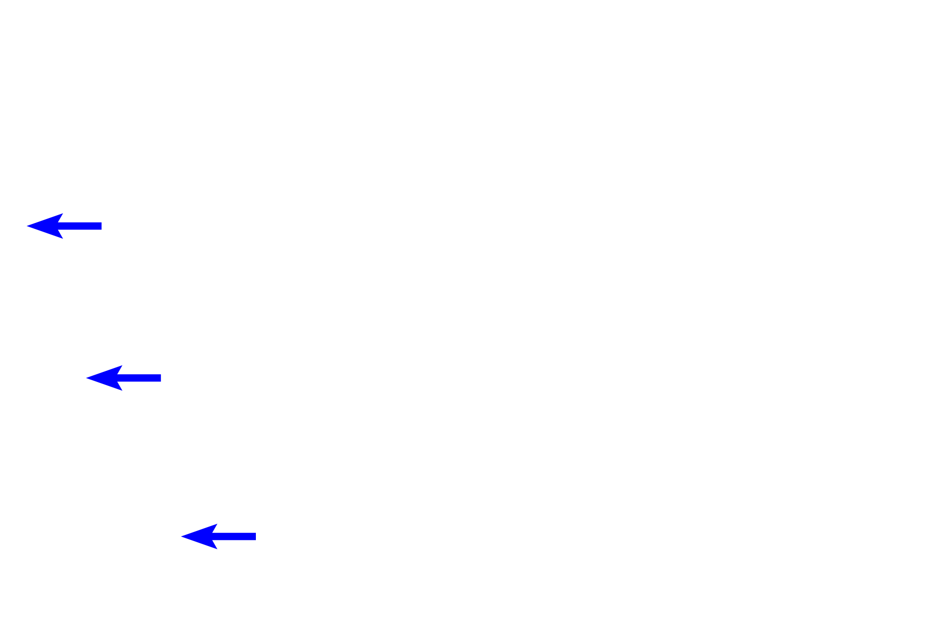 Brunner’s glands (submucosal glands) <p>At the gastro-duodenal junction, the mucus-secreting, simple columnar epithelium (sheet gland) of the pylorus changes to a simple columnar epithelium of absorptive cells (enterocytes) and goblet cells in the duodenum.  Additionally, the duodenum can be differentiated by its villi and by submucosal gland (Brunner’s glands) in the submucosa.  100x</p>

