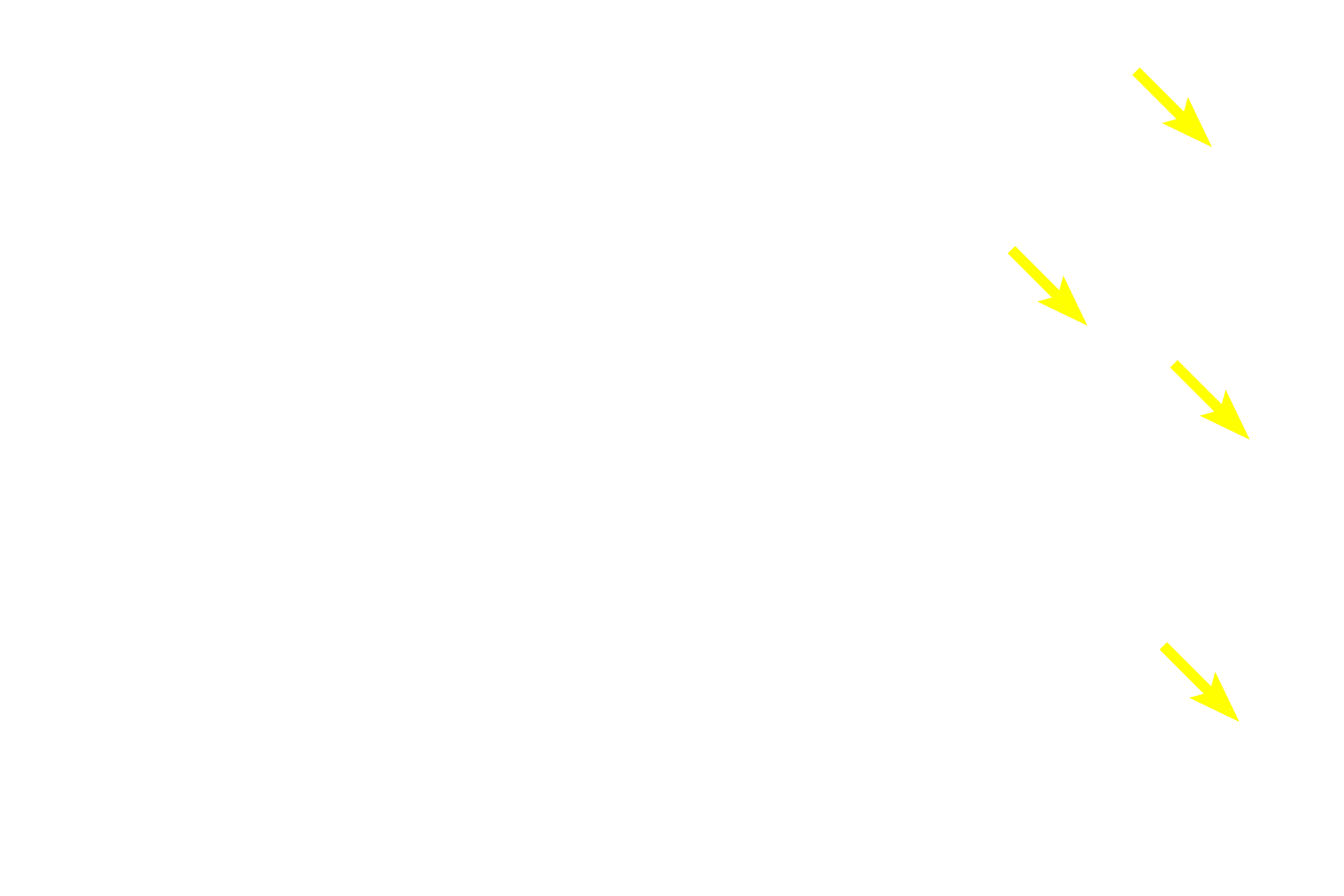  - Mucin <p>A mucus-secreting sheet gland covers the luminal surface and infolds to form gastric pits.  Mucin in these cells is deeply eosinophilic here and appears as red-staining droplets in the apical cytoplasm of the cells.</p>
