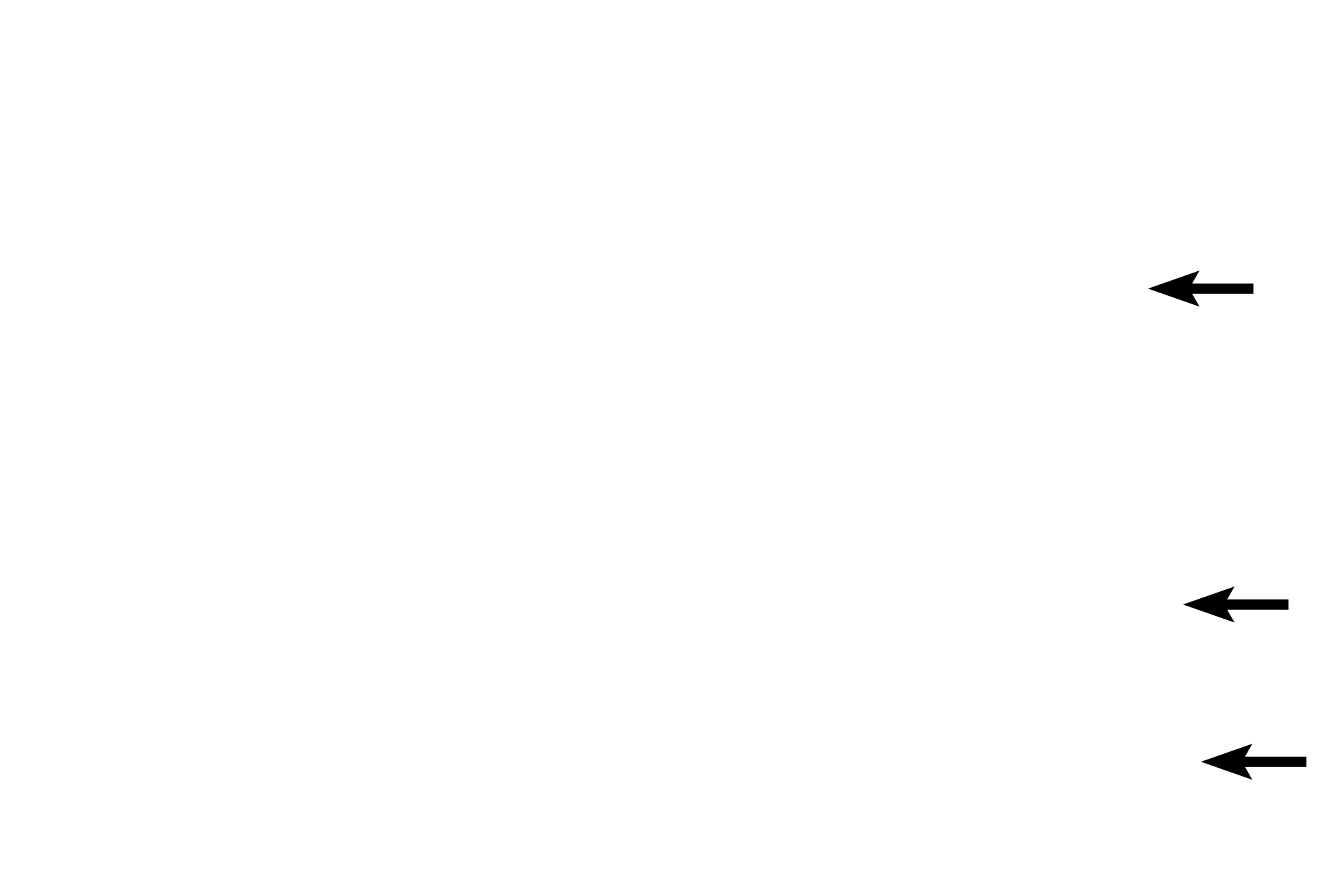  - Opening of gastric pits <p>A mucus-secreting sheet gland covers the luminal surface and infolds to form gastric pits.  Mucin in these cells is deeply eosinophilic here and appears as red-staining droplets in the apical cytoplasm of the cells.</p>
