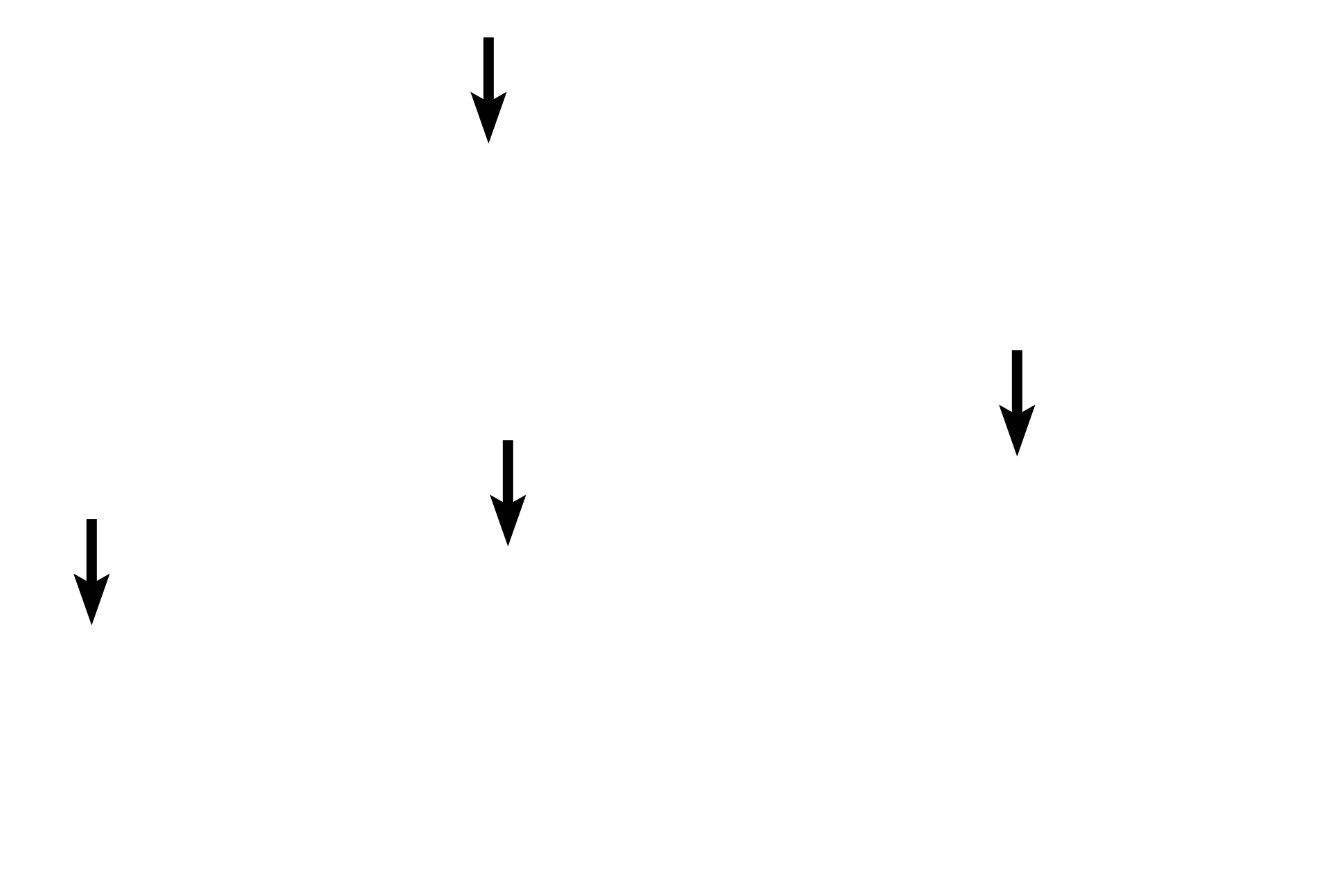 Lamina propria <p>A mucus-secreting sheet gland covers the luminal surface and infolds to form gastric pits.  Mucin in these cells is deeply eosinophilic here and appears as red-staining droplets in the apical cytoplasm of the cells.</p>
