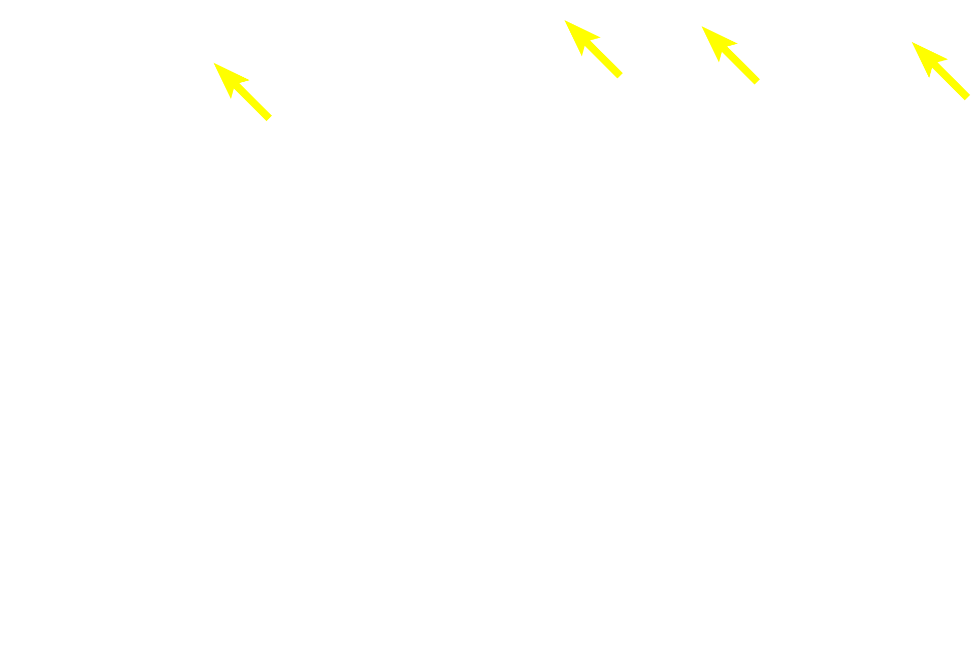  - Sheet gland <p>In the fundus and body of the stomach, gastric pits are much shorter than are the gastric glands.  These glands, termed fundic glands, possess a variety of cell types.  100x</p>
