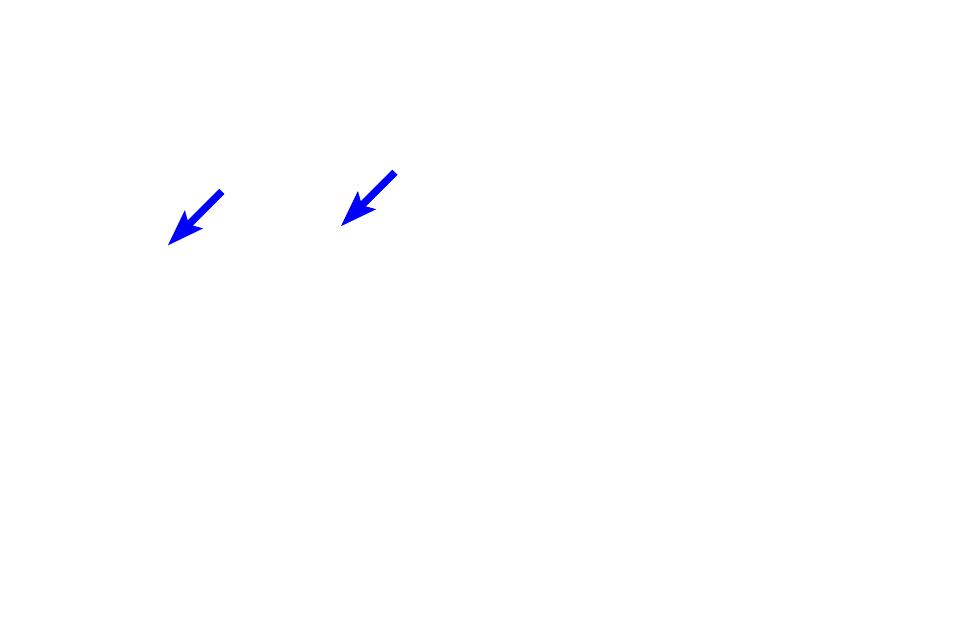  - Branching glands <p>Gastric pits, short in the body and fundus, extend from the surface epithelium to attach to the neck of the glands, where branching occurs.  Gastric glands, including the fundic glands, extend from the gastric pits through the lamina propria to the muscularis mucosae.</p>
