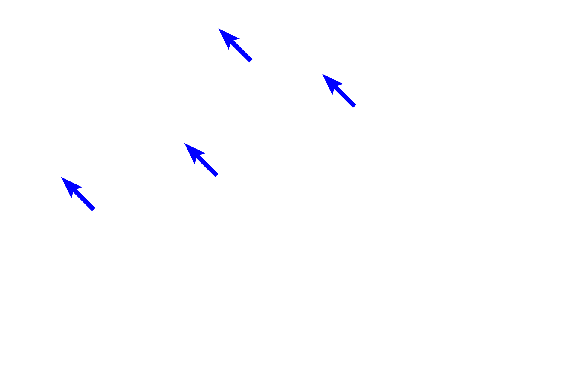 Parietal cells <p>The bases of fundic glands, resting on the muscularis mucosae, are embedded in the loose connective tissue of the lamina propria.  Although parietal cells are located here too, chief cells and enteroendocrine cells predominate in this area.  400x, 100x</p>
