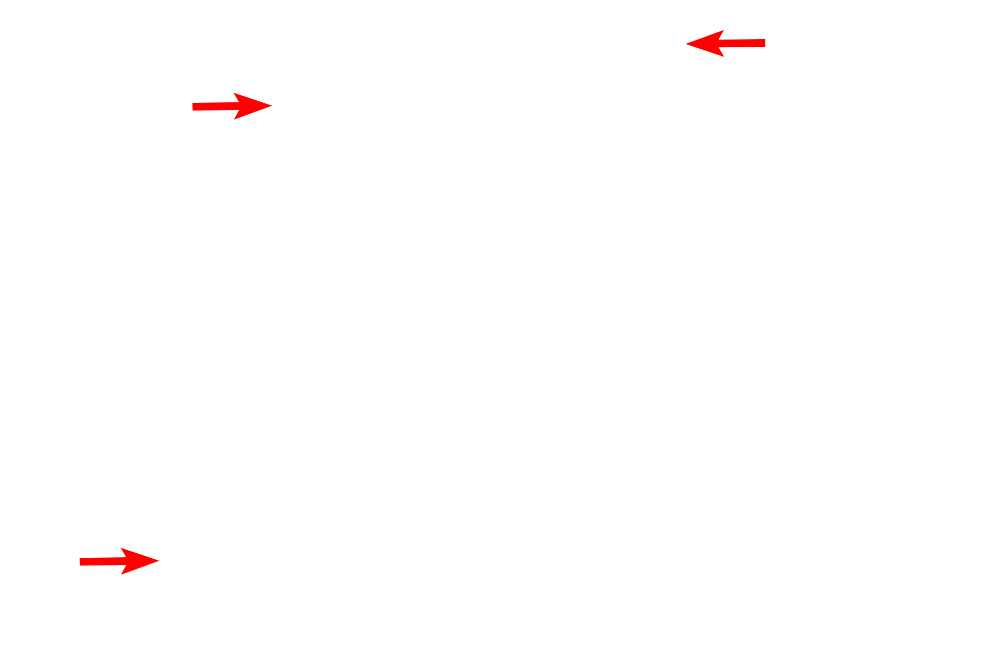Afferent lymphatics > <p>Afferent lymphatics enter from the convex surface, penetrate the capsule and enter the subcapsular sinus.  From this sinus lymph and lymph-borne immune cells percolate through trabecular sinuses lying adjacent to trabeculae and enter medullary sinuses.  Medullary sinuses drain into efferent lymphatics that exit at the hilum.  Sinuses filter lymph and respond to the foreign materials it contains.</p>
