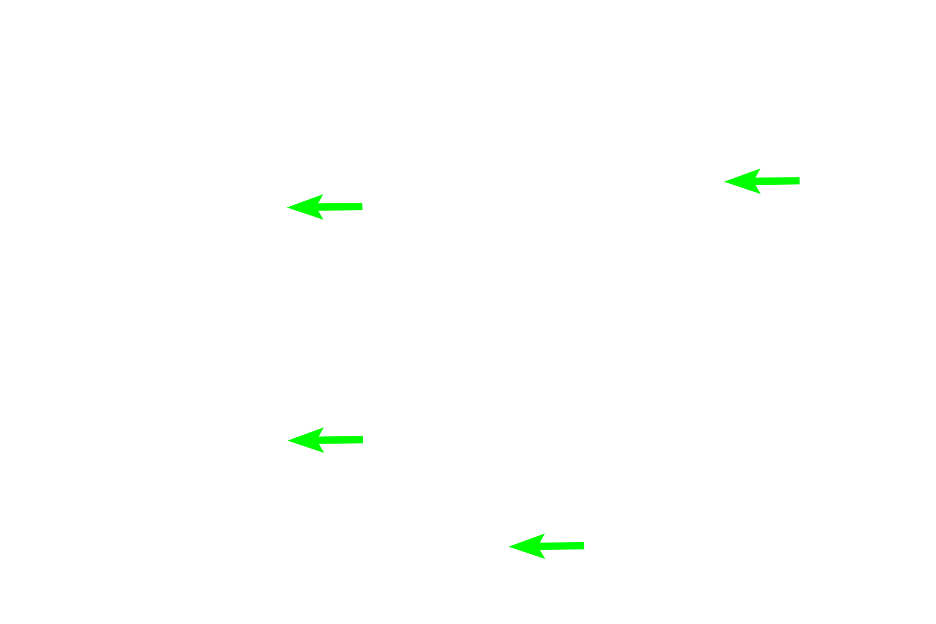 Trabecular sinuses <p>Afferent lymphatics enter from the convex surface, penetrate the capsule and enter the subcapsular sinus.  From this sinus lymph and lymph-borne immune cells percolate through trabecular sinuses lying adjacent to trabeculae and enter medullary sinuses.  Medullary sinuses drain into efferent lymphatics that exit at the hilum.  Sinuses filter lymph and respond to foreign materials it contains.</p>
