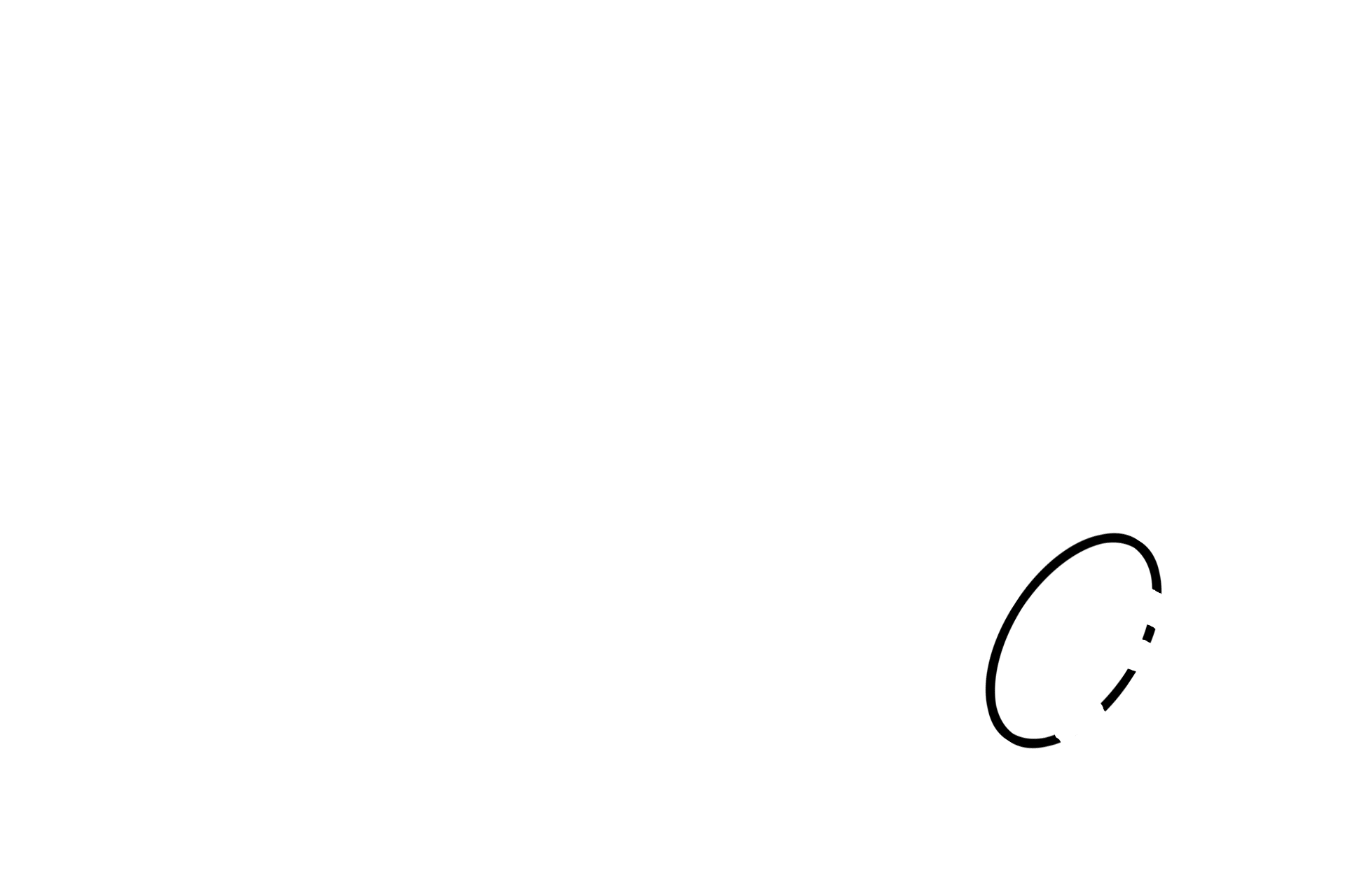 Hilum <p>A lymph node is surrounded by a dense connective tissue capsule that sends short, supportive trabeculae into the node.  Reticular connective tissue provides the stroma for the interior of the lymph node.  The hilum is the indentation in the lymph node where arterial blood enters the node and venous blood and efferent lymph vessels exit.</p>
