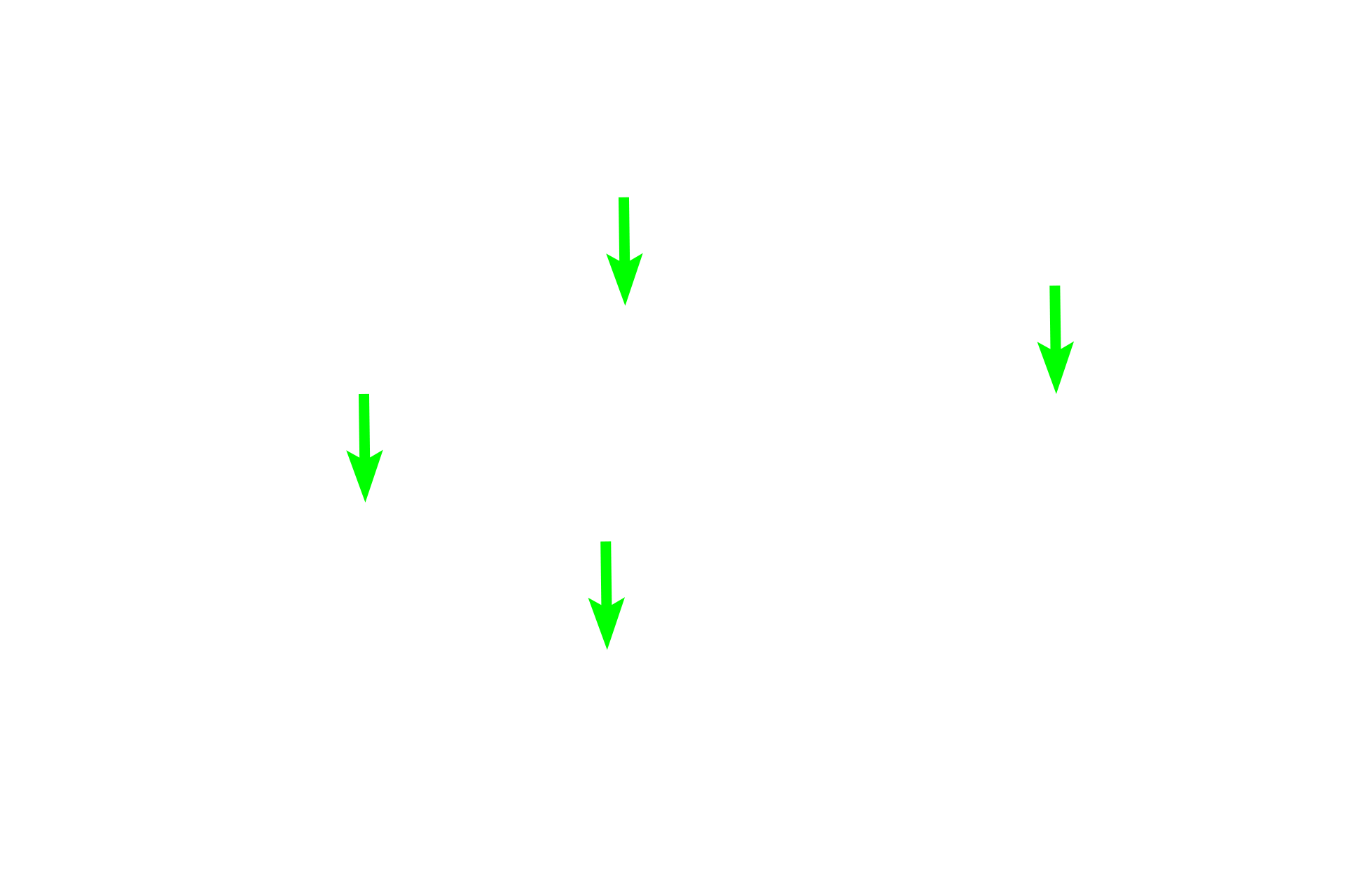  - Deep cortex <p>The outer cortex (superficial cortex, nodular cortex) is filled with lymphoid nodules that are populated mostly by B lymphocytes.  The inner paracortex (deep cortex) (dashed, black ovals) resembles diffuse lymphoid tissue and is populated mostly by T lymphocytes.</p>
