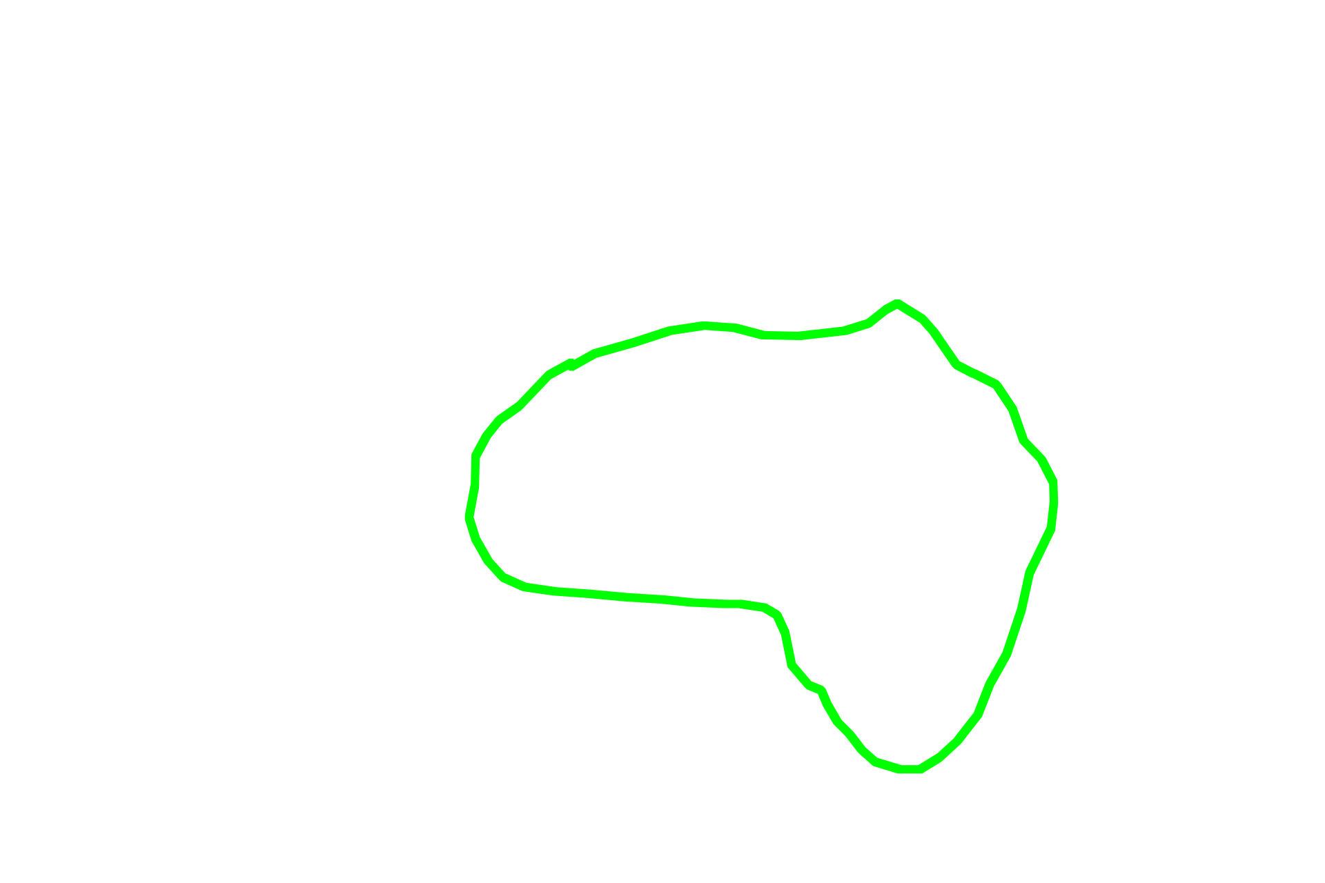  Medulla > <p>The medulla consists of a series of medullary cords (B-dependent areas), that are finger-like projections of lymphoid tissue, and large channels, called medullary sinuses, that receive lymph from the cortical sinuses.</p>
