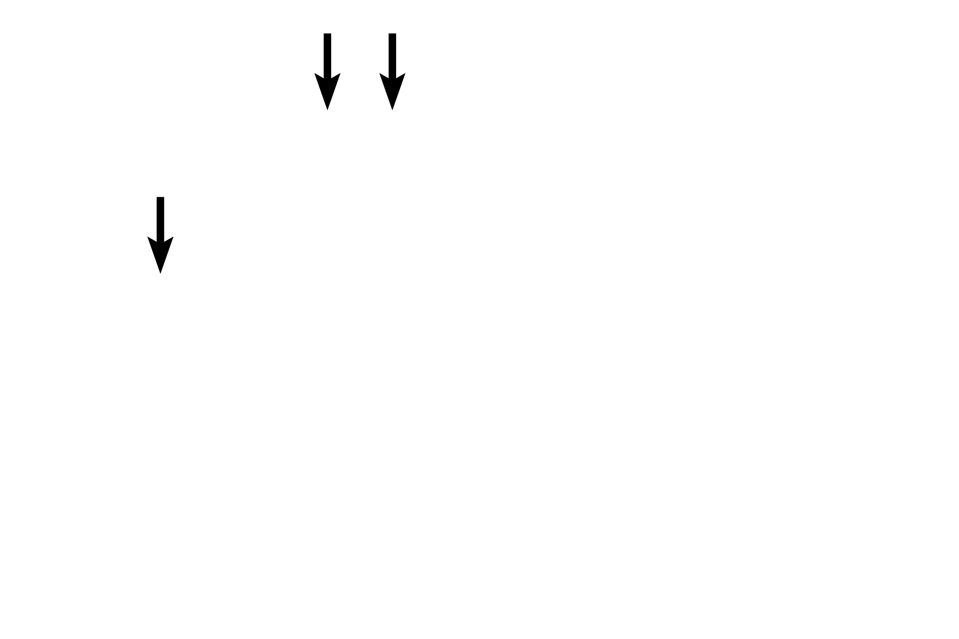 Subcapsular sinus <p>Each lymph node is surrounded by a dense connective tissue capsule.  Afferent lymphatics pierce the capsule to enter the subcapsular sinus lying beneath it.  The subcapsular sinus drains into trabecular (intermediate) sinuses that traverse the cortex to connect with medullary sinuses.  Medullary sinuses anastomose to form the efferent lymphatic that exits at the hilum.</p>
