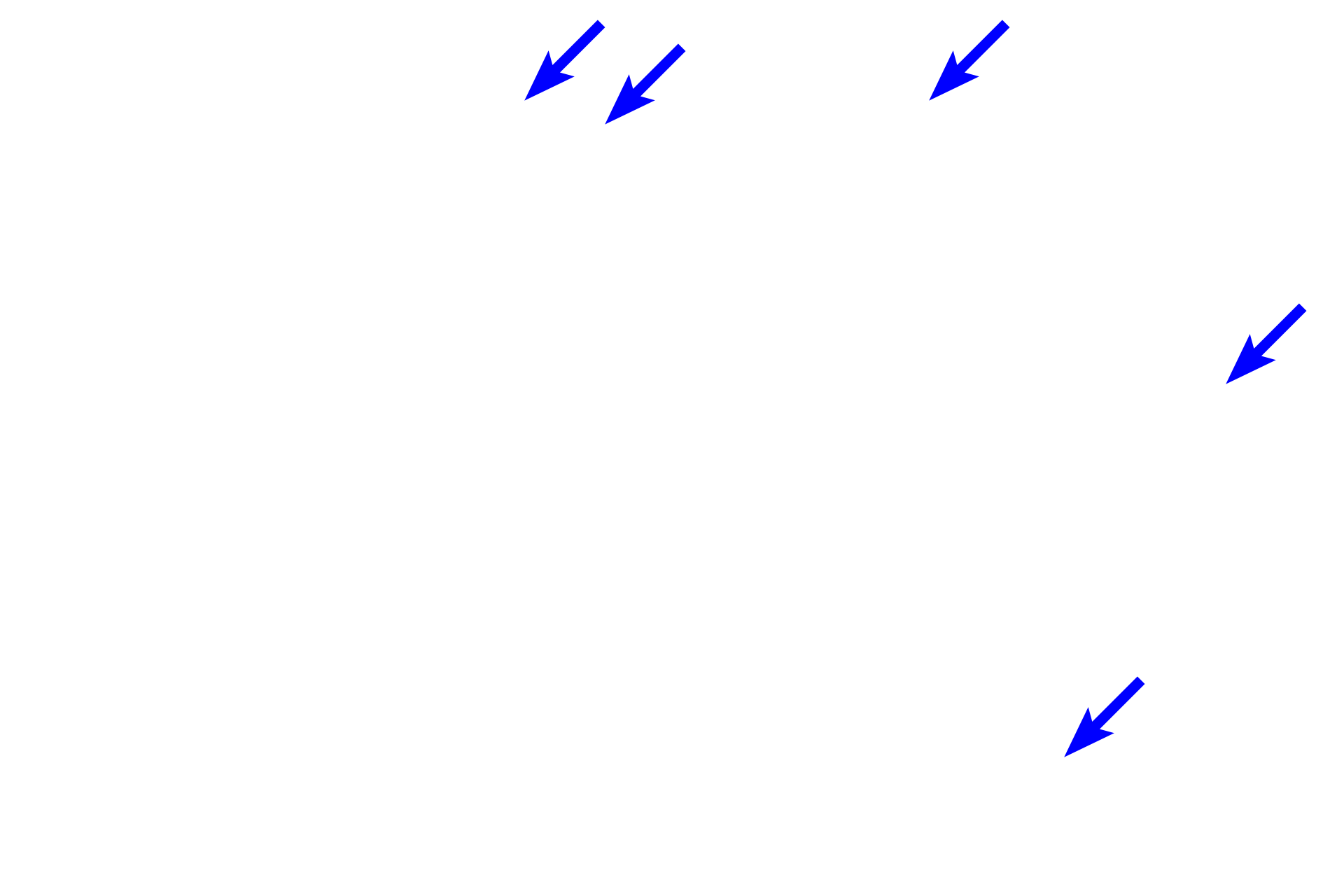  - Lymphoid nodules <p>The outer cortex (superficial cortex, nodular cortex) contains lymphoid nodules that are populated mostly by B lymphocytes.  The inner paracortex (deep cortex) resembles diffuse lymphoid tissue and is populated mostly by T lymphocytes.</p>
