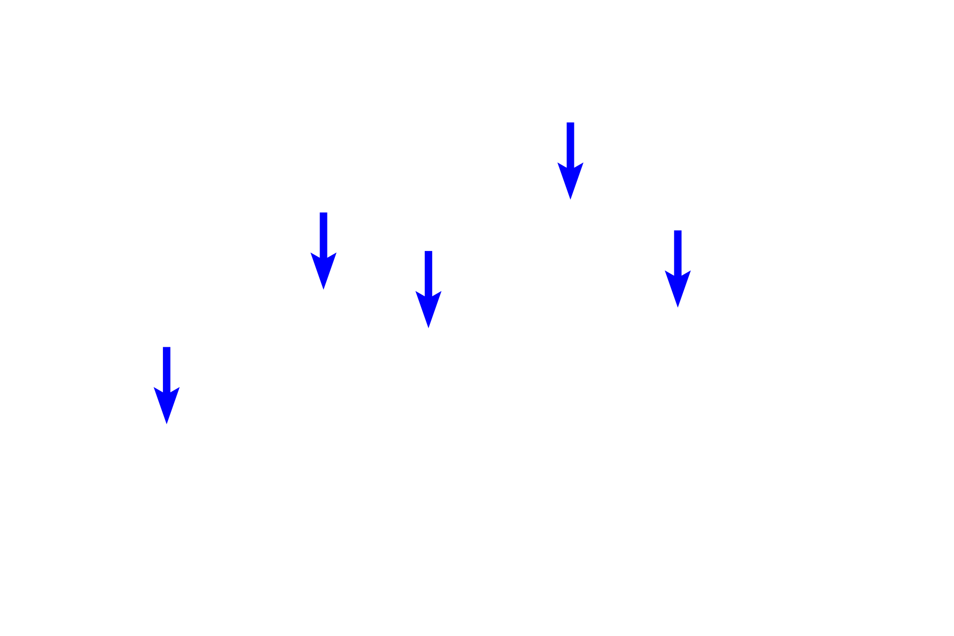  - Medullary sinuses <p>The medulla consists of a series of medullary cords (B-dependent areas), that are finger-like projections of lymphoid tissue.  Between the cords are large channels, called medullary sinuses, that receive lymph from the cortical sinuses.  The medullary sinuses contain large numbers of lymphocytes.</p>
