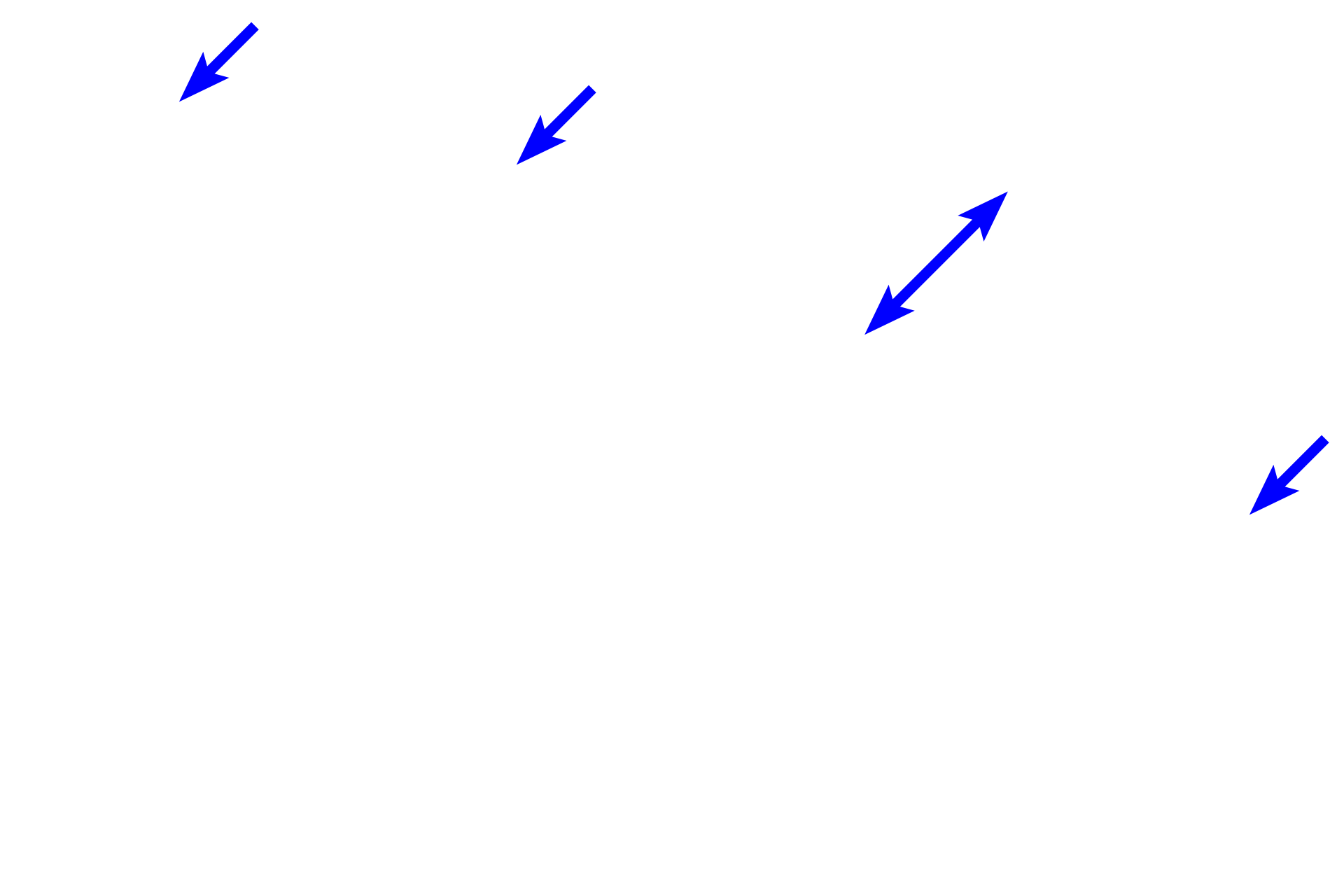 Capsule <p>A capsule and the underlying subcapsular sinus surround the outer cortical zone. Lymph, together with the lymph-borne immune cells, first enters the subcapsular sinus via afferent lymphatic vessels. The subcapsular sinus consists of a loose meshwork of reticular fibers and macrophages that together trap and phagocytose particulate material.  400x</p>
