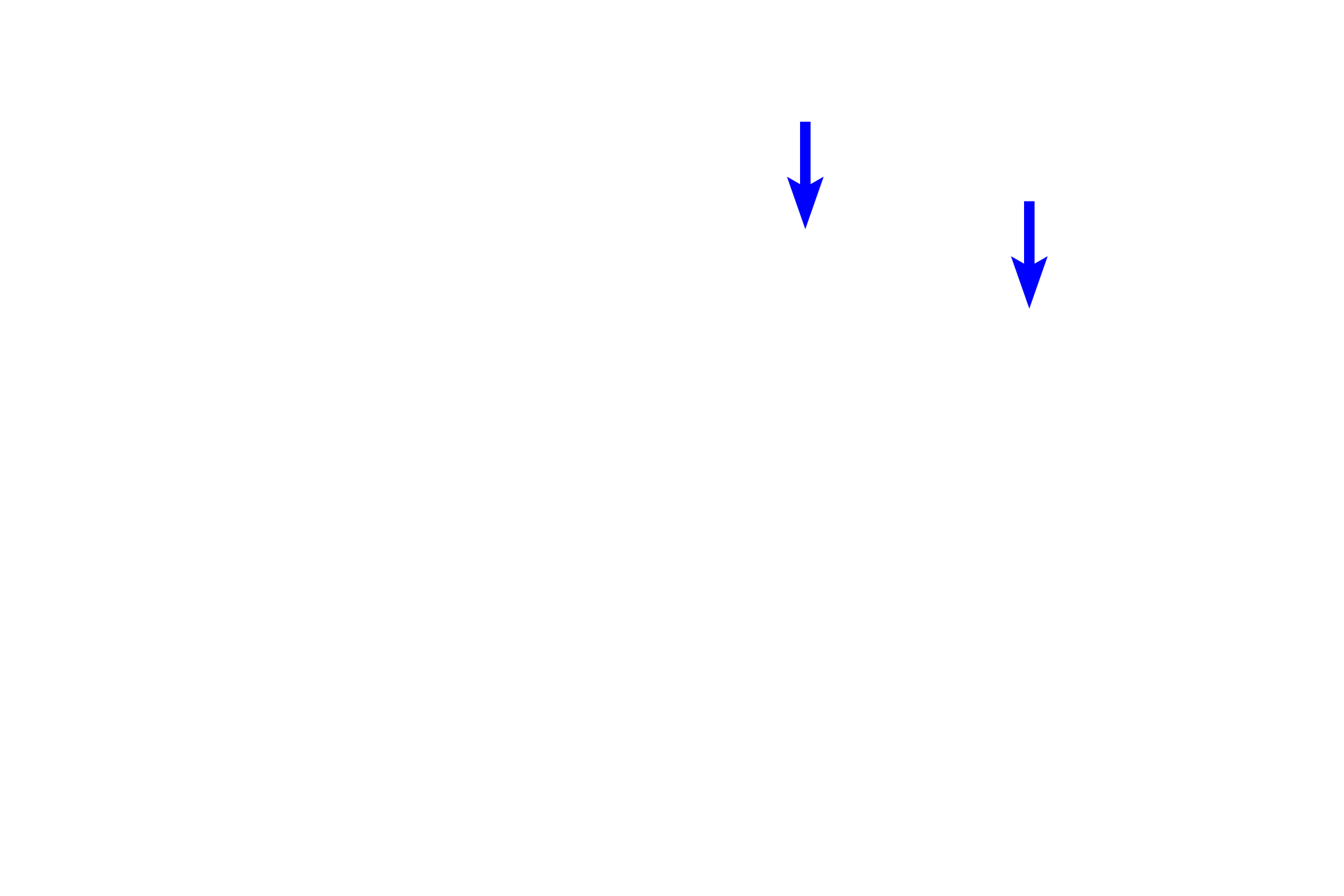 Afferent lymphatic vessel > <p>An afferent lymphatic vessel is seen near its point of opening into the subcapsular sinus and thus is incorporated into the capsule.  The vessel contains valves, typical of larger lymphatic vessels, that insure one-way flow of the lymph.</p>
