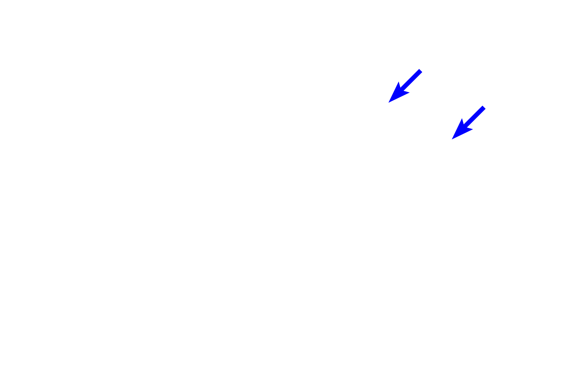 Valves <p>An afferent lymphatic vessel is seen near its point of opening into the subcapsular sinus and thus is incorporated into the capsule.  The vessel contains valves, typical of larger lymphatic vessels, that insure one-way flow of the lymph.</p>
