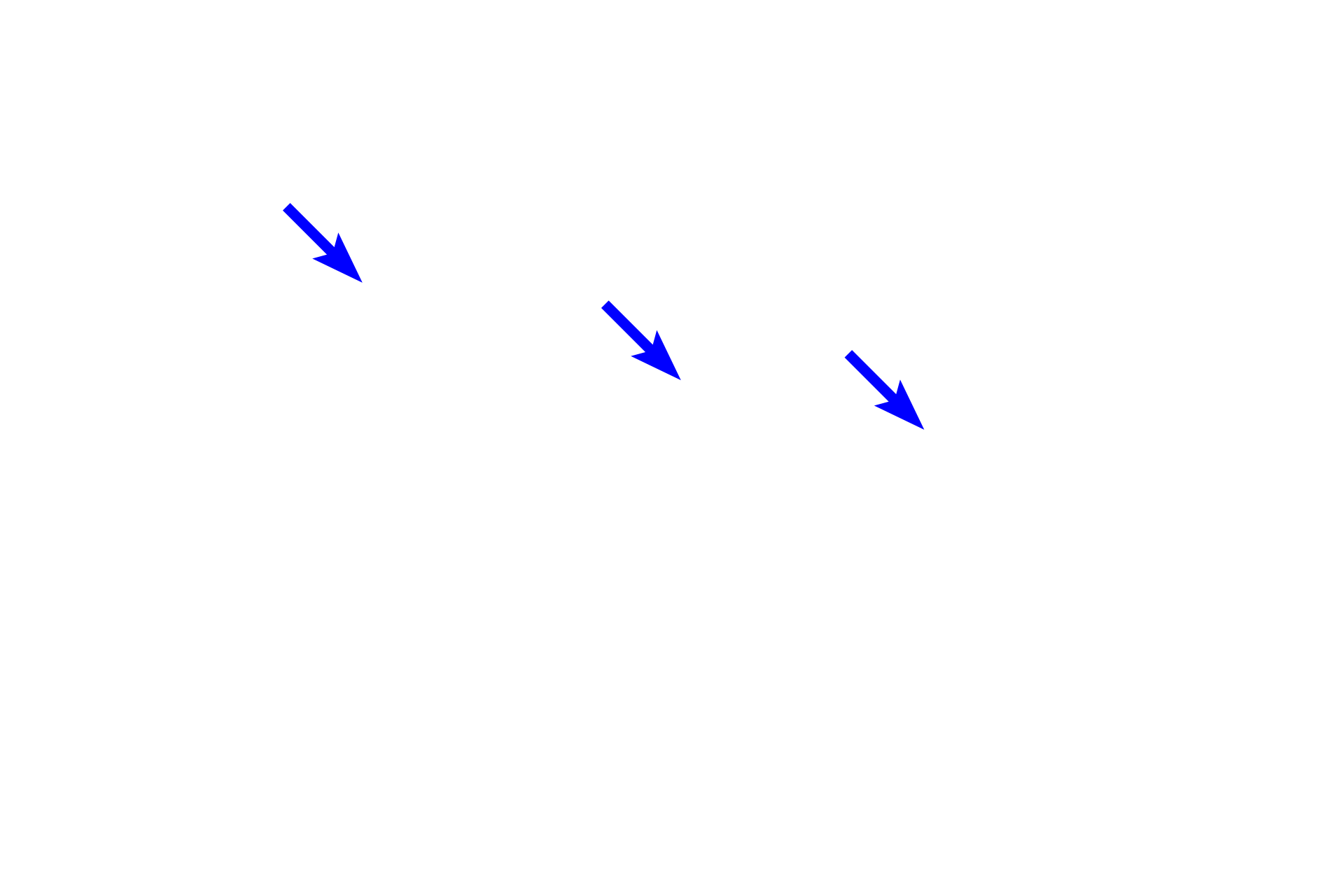 Lymphocytes <p>Sinuses of the lymph node are not open channels as are blood sinuses.  Rather, these sinuses are lined by an endothelium and are spanned by a meshwork of reticular fibers ensheathed by reticular cells. Thus, lymph flow is retarded, allowing macrophages, transported to the node through afferent lymphatics, to phagocytose antigenic material.</p>
