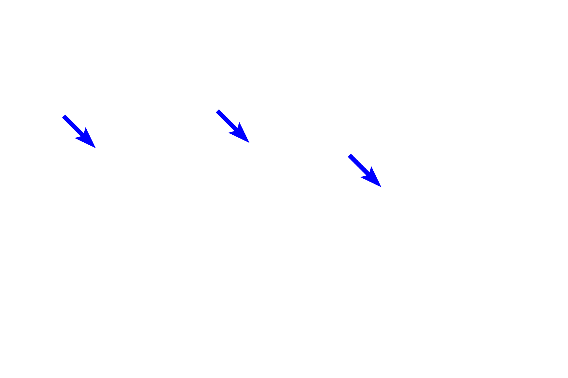 Reticular cells <p>Sinuses of the lymph node are not open channels as are blood sinuses.  Rather, these sinuses are lined by an endothelium and are spanned by a meshwork of reticular fibers ensheathed by reticular cells. Thus, lymph flow is retarded, allowing macrophages, transported to the node through afferent lymphatics, to phagocytose antigenic material.</p>
