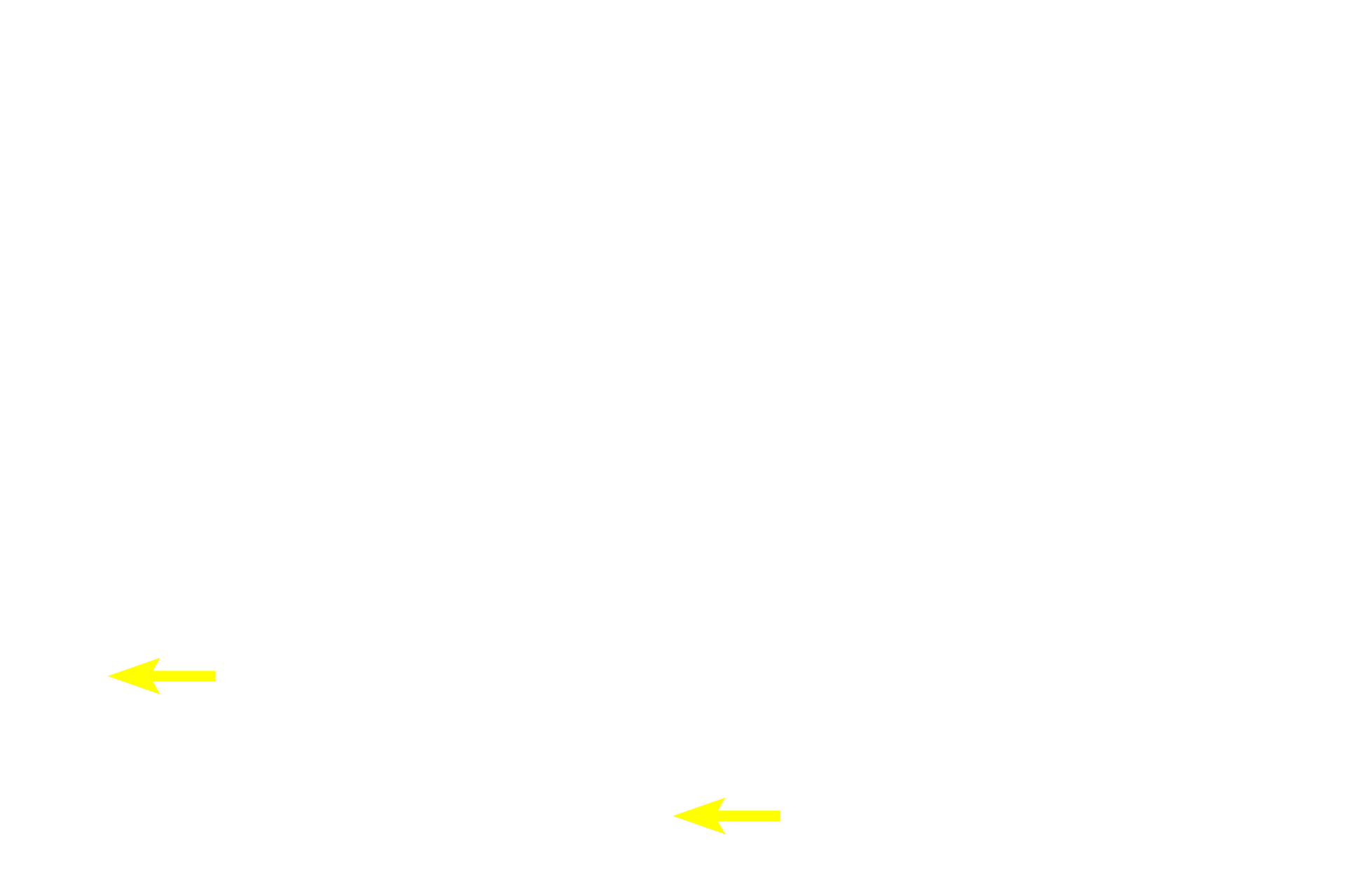 High endothelial venules <p>Sinuses of the lymph node are not open channels as are blood sinuses.  Rather, these sinuses are lined by an endothelium and are spanned by a meshwork of reticular fibers ensheathed by reticular cells. Thus, lymph flow is retarded, allowing macrophages, transported to the node through afferent lymphatics, to phagocytose antigenic material.</p>
