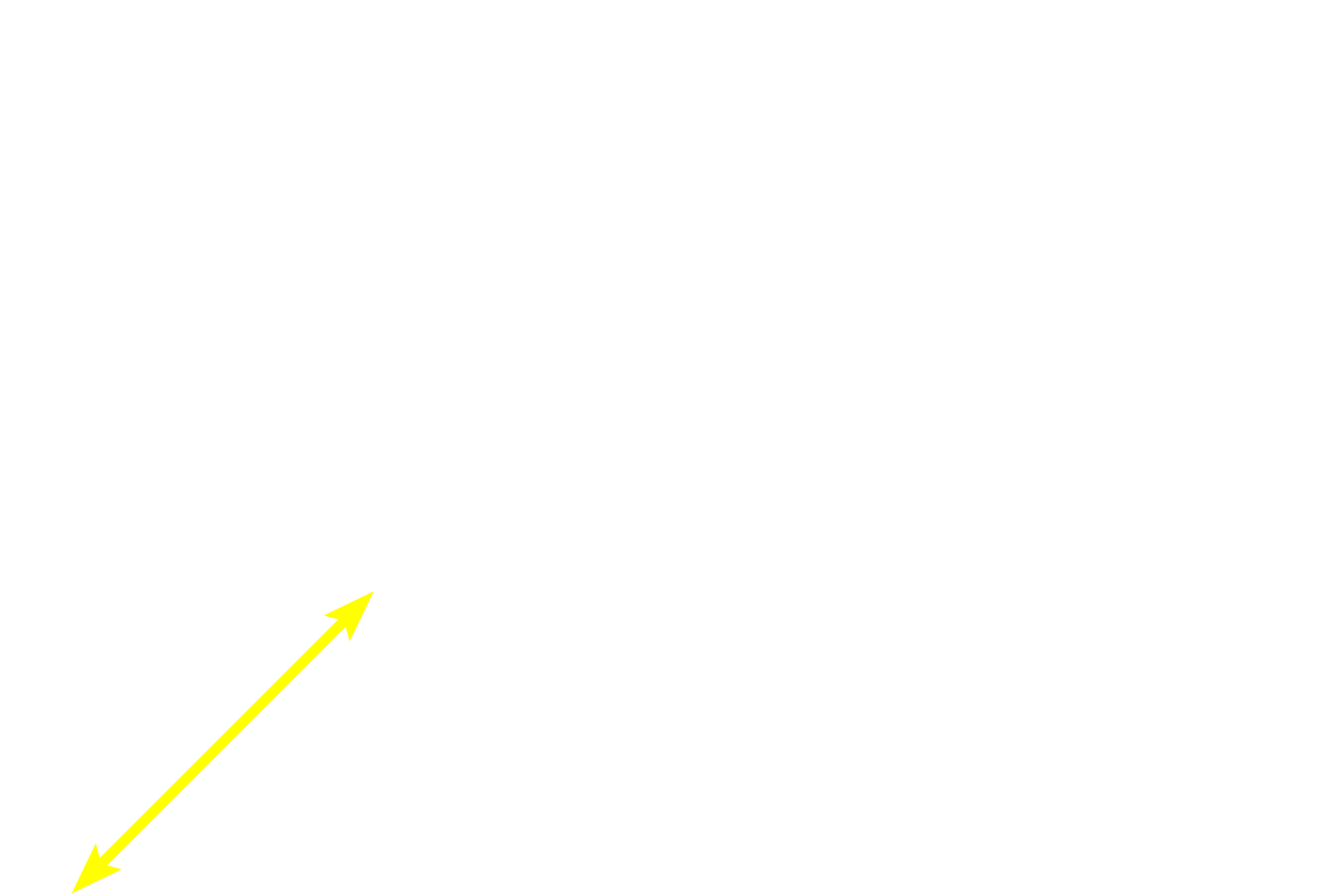 Deep cortex (paracortex) <p>The outer cortex of a lymph node is filled with B-dependent lymphoid nodules and lies just beneath the capsule and the subcapsular sinus.  A portion of two trabecular sinuses are also present, but these sinuses are difficult to appreciate as they are filled with cells.  100x</p>
