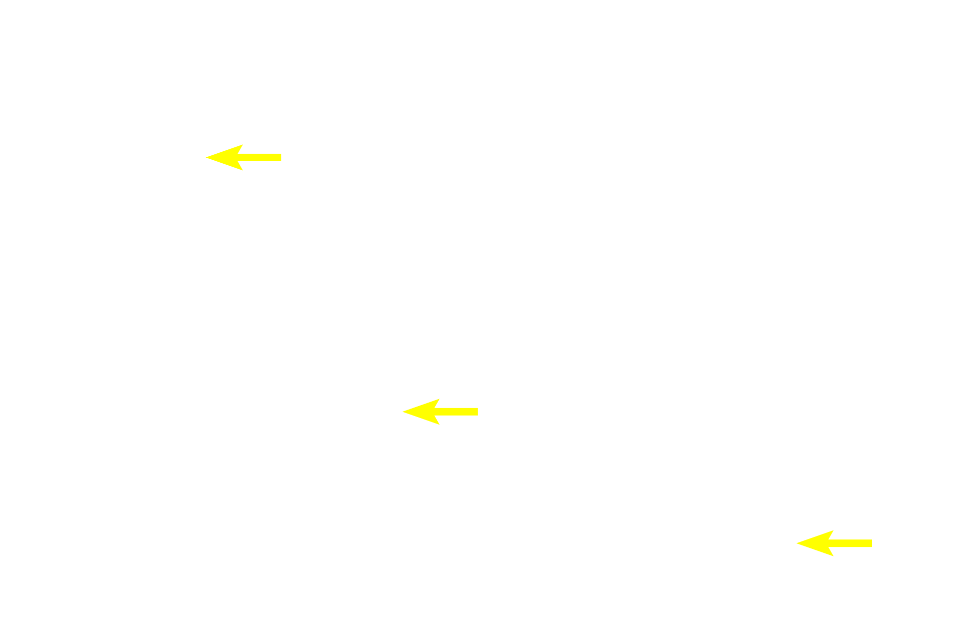 High endothelial venules <p>The outer cortex of a lymph node is filled with B-dependent lymphoid nodules and lies just beneath the capsule and the subcapsular sinus.  A portion of two trabecular sinuses are also present, but these sinuses are difficult to appreciate as they are filled with cells.  100x</p>
