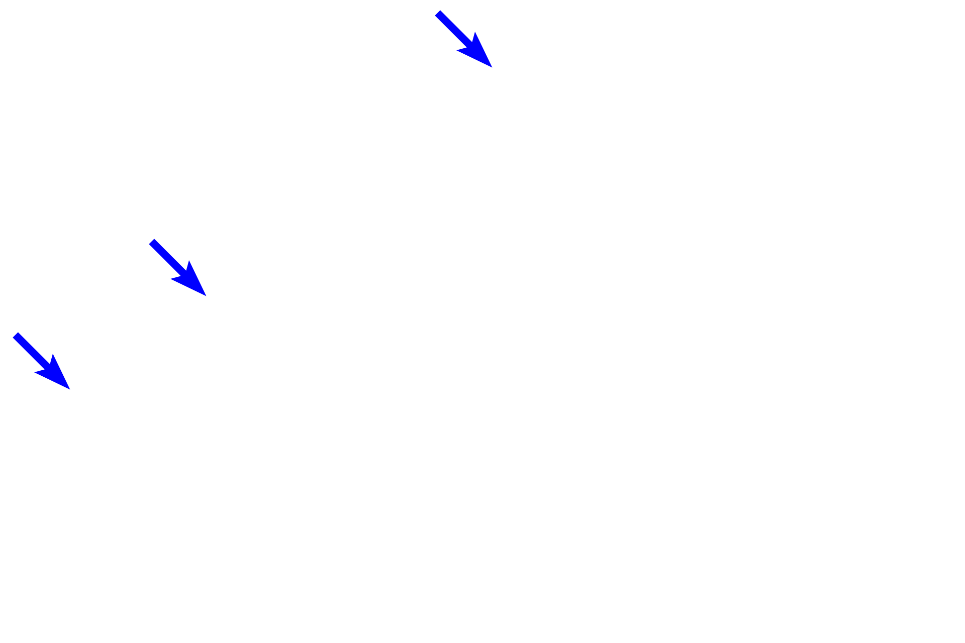 Capsule > <p>The capsule surrounding the lymph node is composed of dense connective tissue and sends short trabeculae into the node to provide support.</p>
