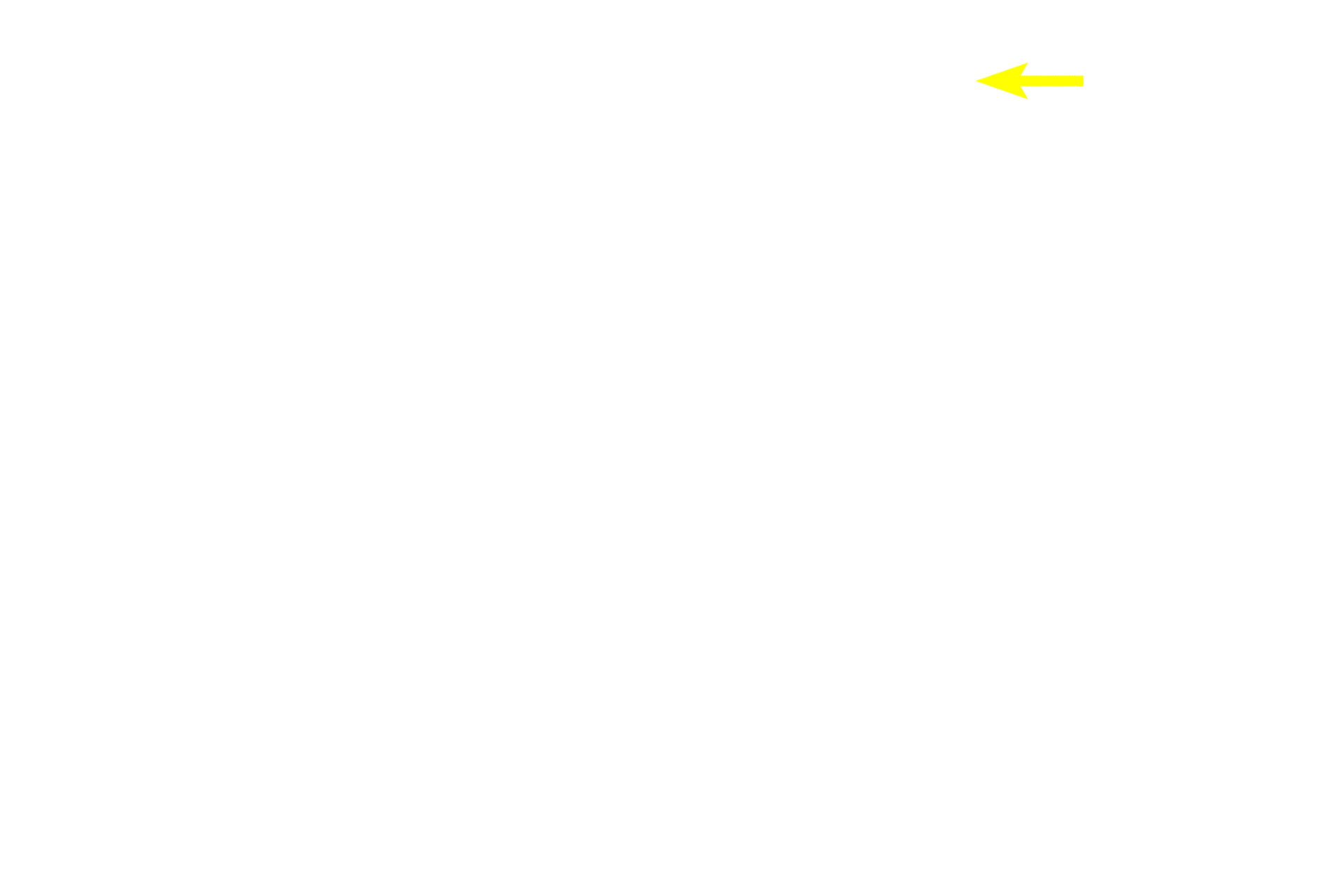 Trabeculum <p>The capsule surrounding the lymph node is composed of dense connective tissue and sends short trabeculae into the node to provide support.</p>
