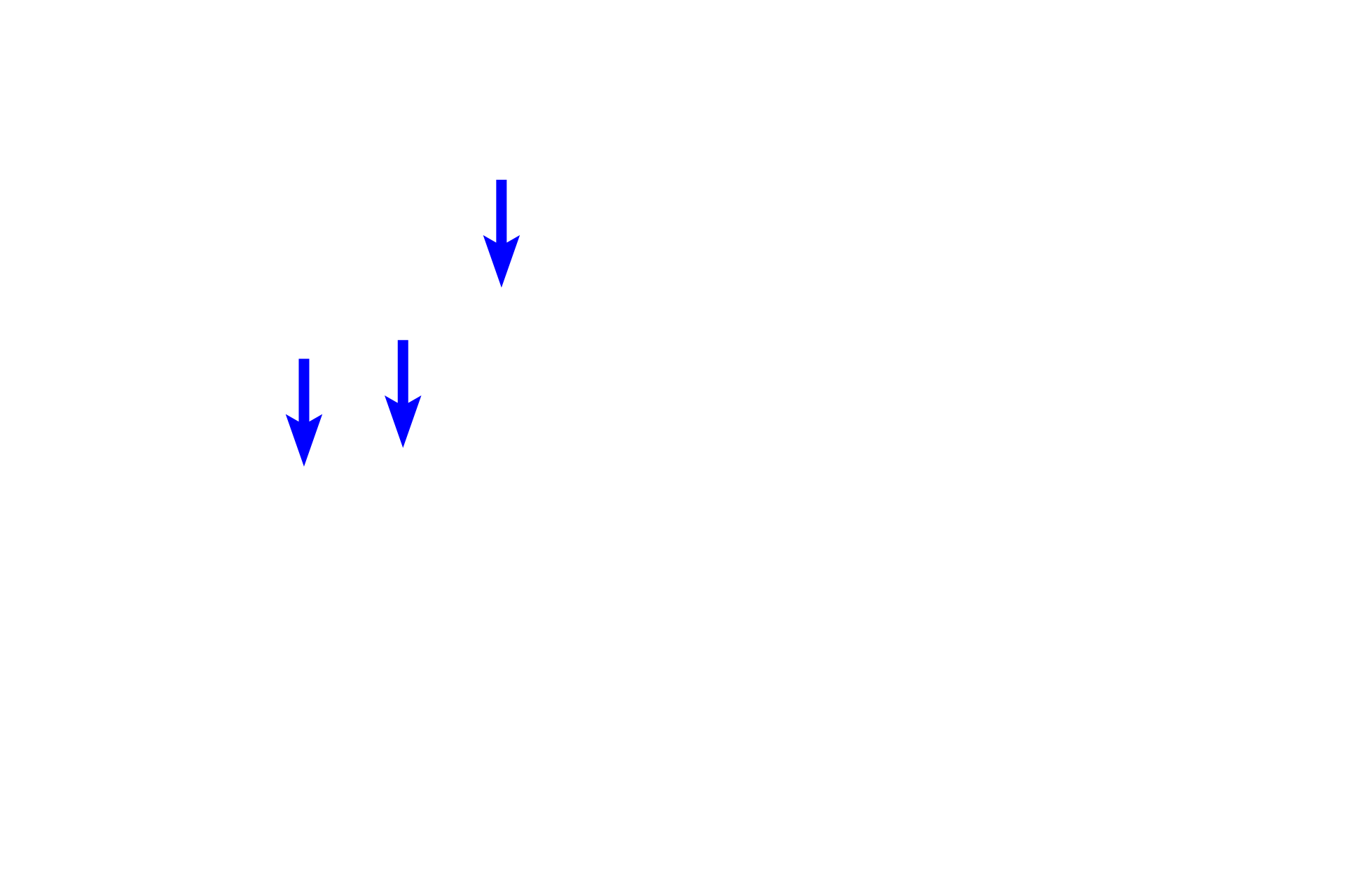 Subcapsular sinus > <p>Afferent lymph vessels penetrate the node at its convex surface, where lymph enters the subcapsular sinus.  From there, lymph percolates through trabecular (intermediate) sinuses adjacent to trabeculae, and into medullary sinuses.  Any foreign matter carried in the lymph is exposed to and processed by macrophages occupying these sinuses.</p>
