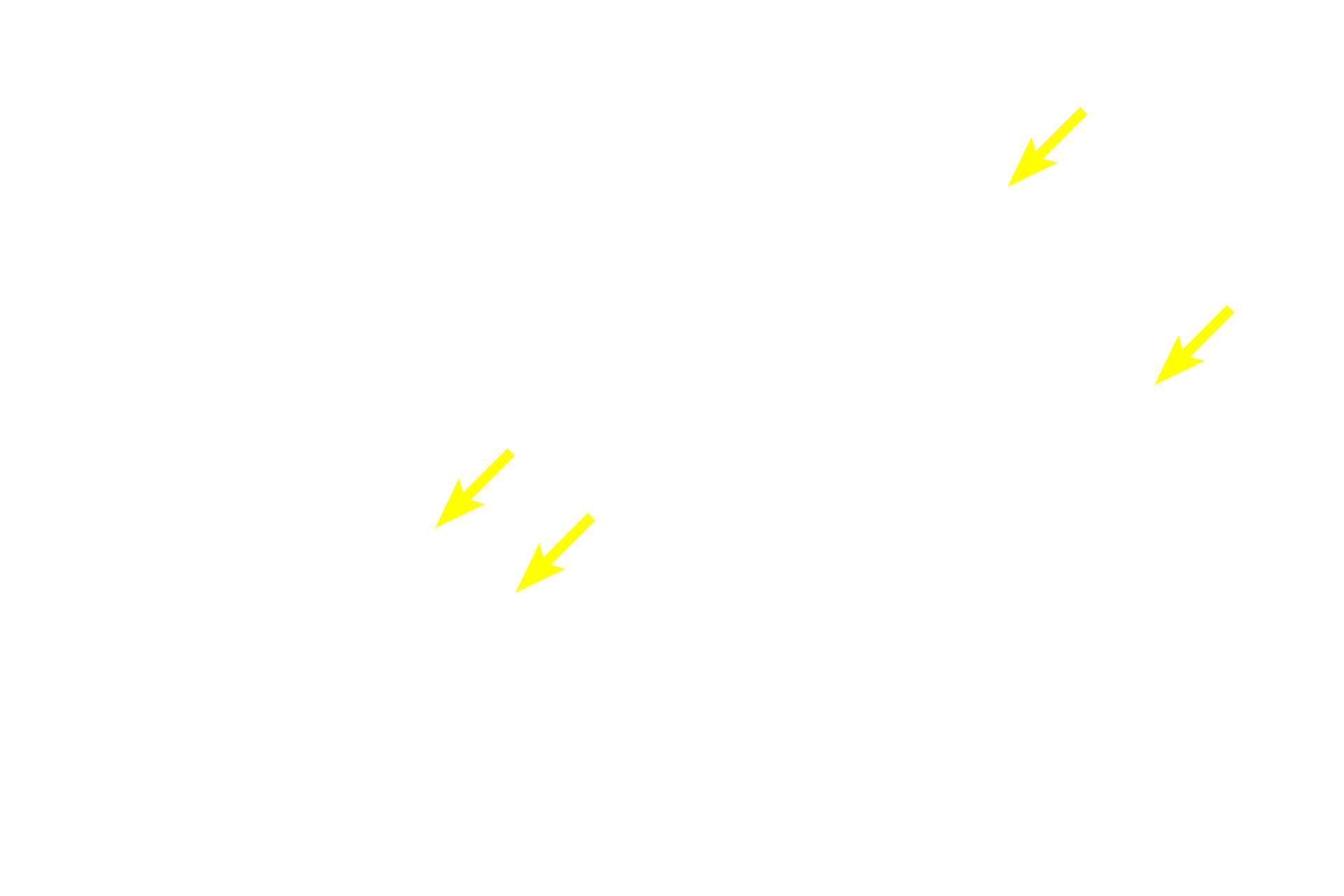 Trabecular sinuses <p>Afferent lymph vessels penetrate the node at its convex surface, where lymph enters the subcapsular sinus.  From there, lymph percolates through trabecular (intermediate) sinuses adjacent to trabeculae, and into medullary sinuses.  Any foreign matter carried in the lymph is exposed to and processed by macrophages occupying these sinuses.</p>
