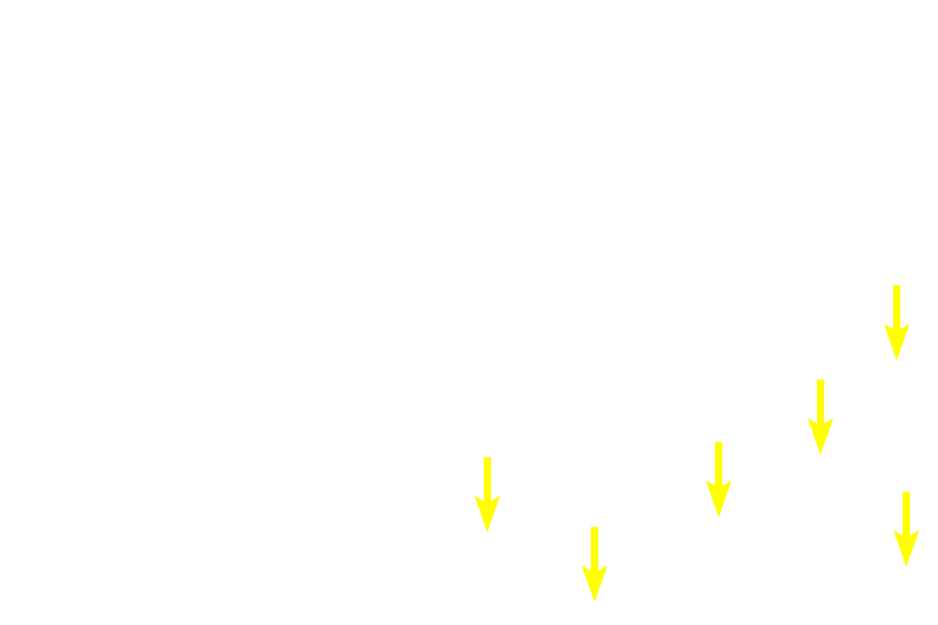 Medullary sinuses <p>Afferent lymph vessels penetrate the node at its convex surface, where lymph enters the subcapsular sinus.  From there, lymph percolates through trabecular (intermediate) sinuses adjacent to trabeculae, and into medullary sinuses.  Any foreign matter carried in the lymph is exposed to and processed by macrophages occupying these sinuses.</p>
