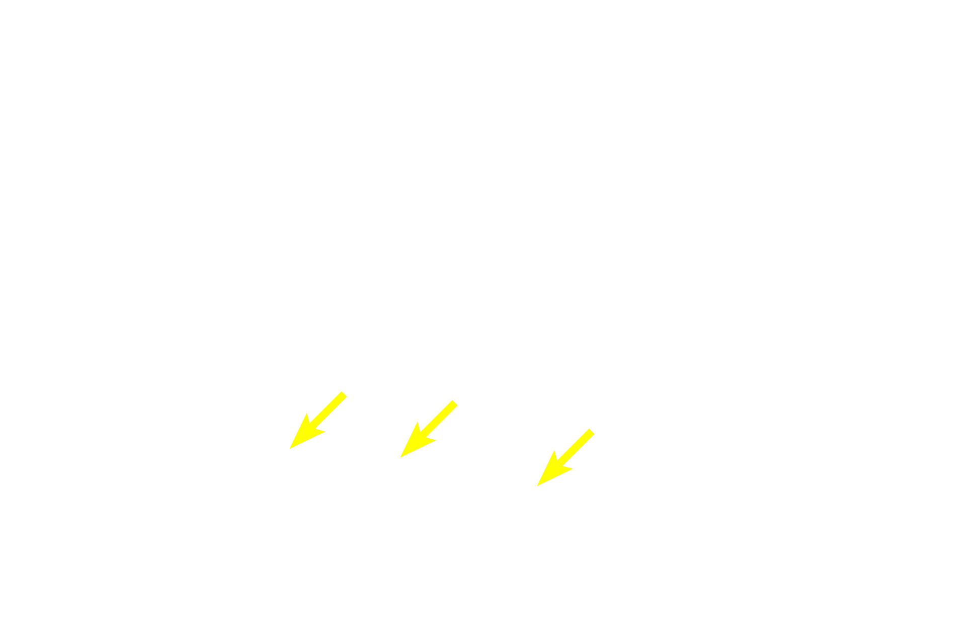 High endothelial venules <p>The paracortex or deep cortex is a T-dependent area possessing high endothelial venules (lined with simple cuboidal epithelium) and ordinary venules (lined by simple squamous epithelium). Lymphocytes leave the high endothelial venules to enter lymphatic tissue, where they initiate an immune response in the lymph node.  400x</p>
