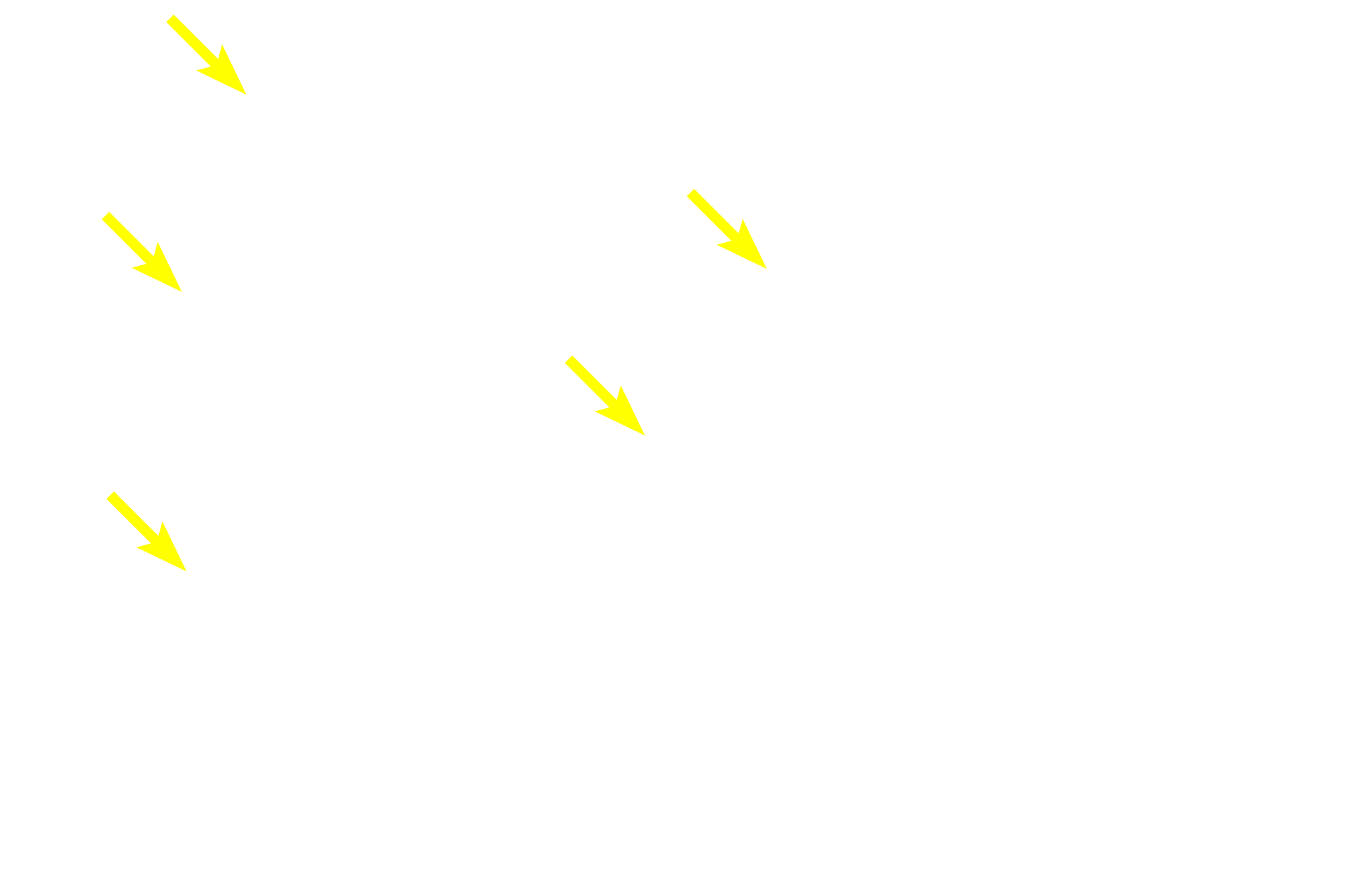 Reticular cells <p>The paracortex or deep cortex is a T-dependent area possessing high endothelial venules (lined with simple cuboidal epithelium) and ordinary venules (lined by simple squamous epithelium). Lymphocytes leave the high endothelial venules to enter lymphatic tissue, where they initiate an immune response in the lymph node.  400x</p>
