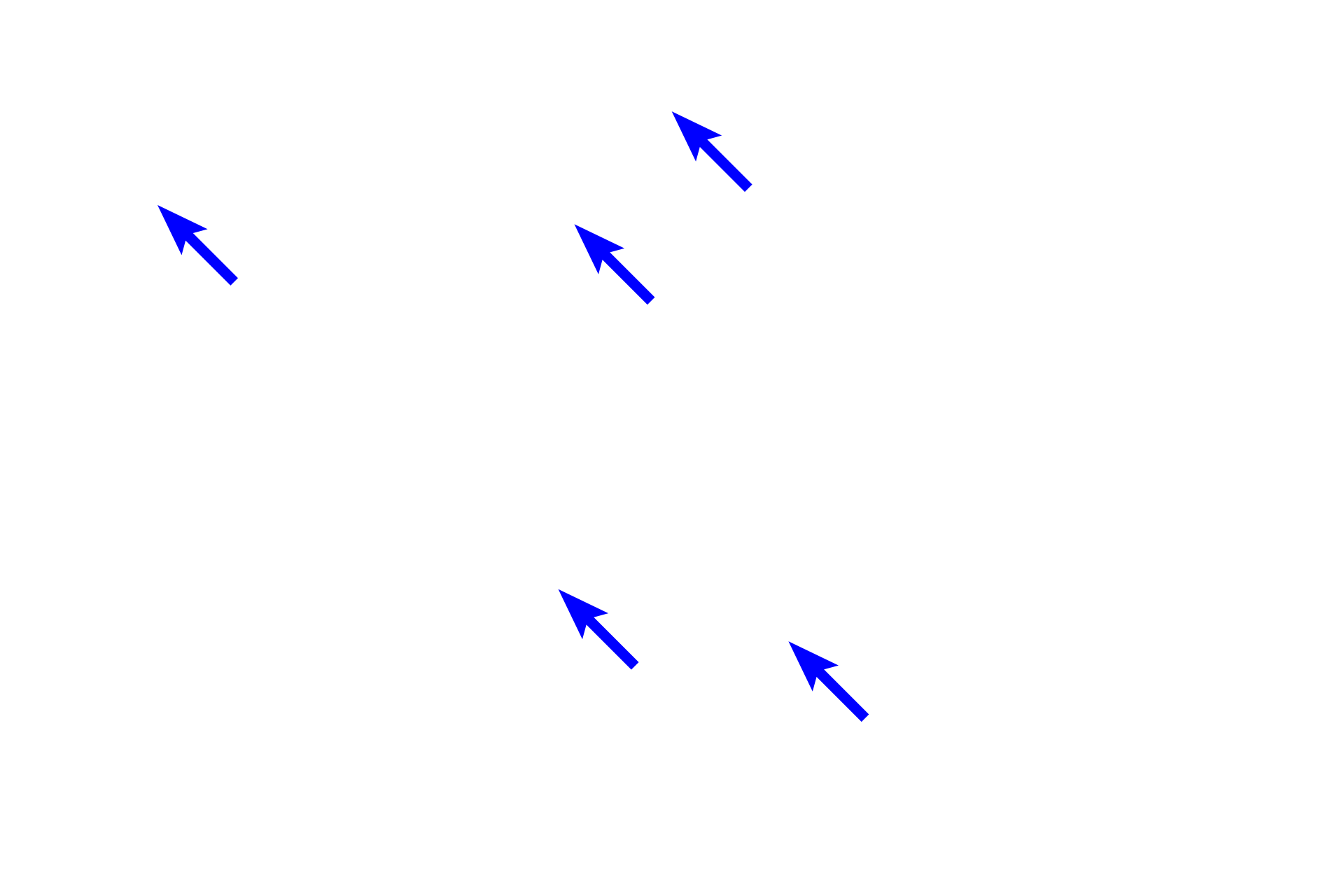 Medullary cords <p>The medulla contains medullary cords and medullary sinuses located between the cords. The medullary cords are composed primarily of B lymphocytes and plasma cells along with macrophages, lymphocytes and reticular cells.  The lymph-filled medullary sinuses contain macrophages, lymphocytes and a network of reticular cells and fibers.  200x</p>
