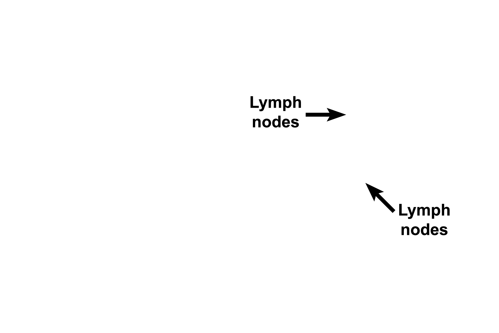  - Lymph nodes > <p>Tissue fluid filtered by MALT structures accumulates as lymph in lymph vessels, accompanied by lymphocytes from MALT.  Located along these lymph vessels are lymph nodes that filter lymph and respond to the presence of any foreign agents carried in it.</p>
