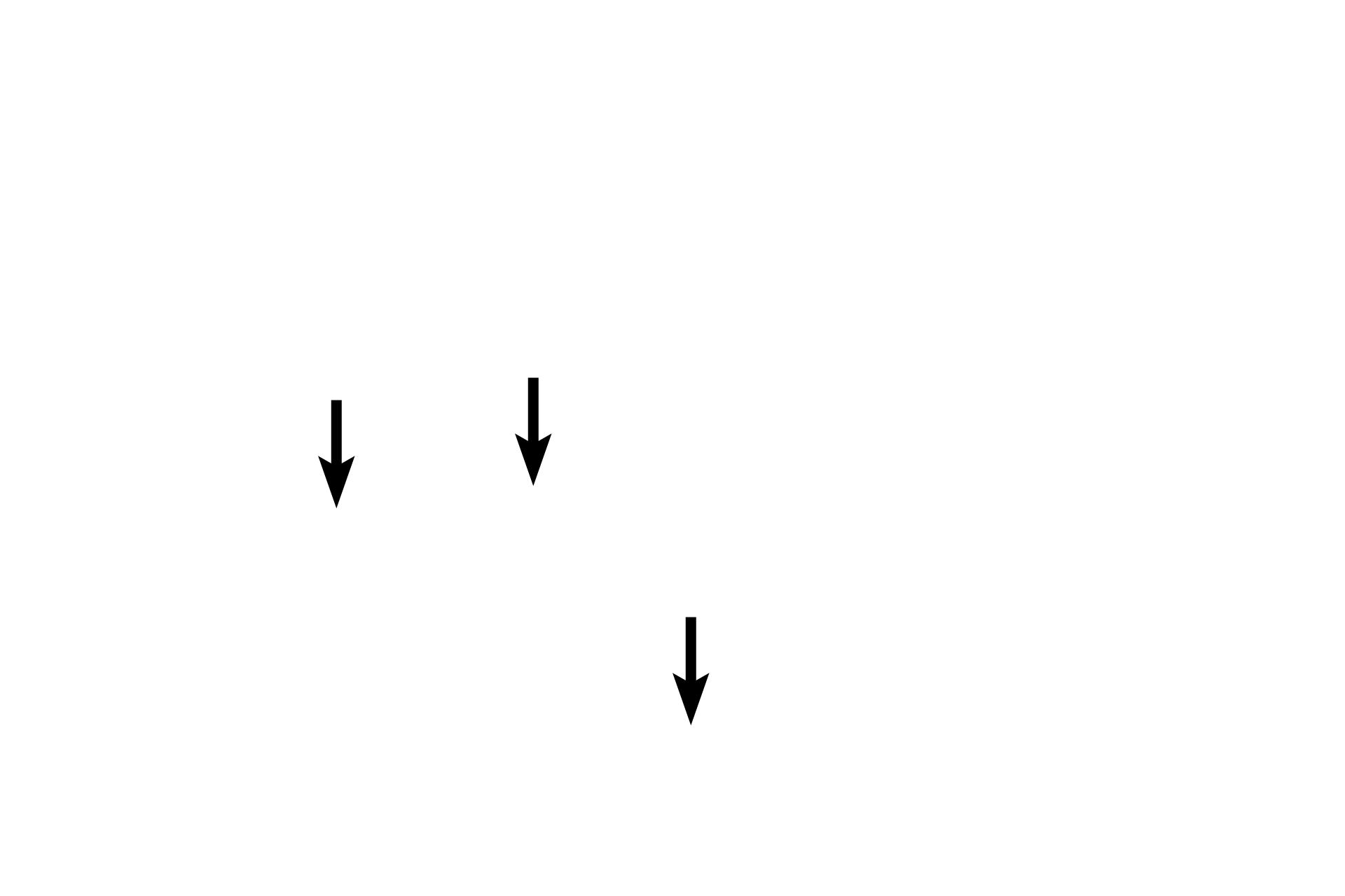 Trabecula <p>Because the spleen projects into the abdominal cavity, it is covered by a serosa, which overlies a dense connective tissue capsule. Long trabeculae extend from the capsule into the organ. Arteries enter the spleen at its hilum and travel in the trabeculae to supply splenic parenchyma.  Veins leave the parenchyma, enter the trabeculae and exit at the hilum.  Reticular connective tissue forms the stroma of the splenic interior.</p>
