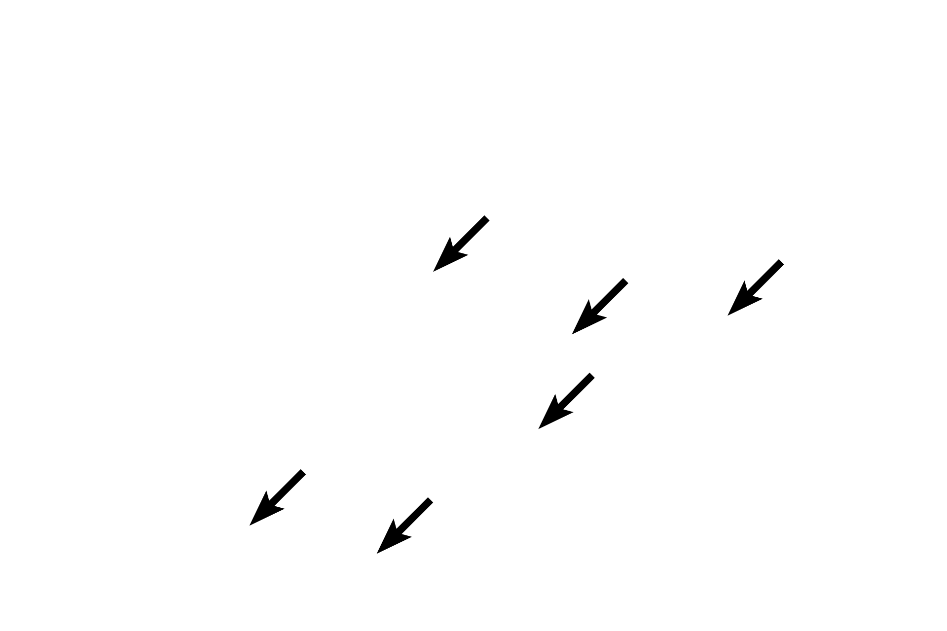 White pulp > <p>The white pulp surrounds arterioles after they leave the trabeculae.  White pulp consists of both diffuse (T-dependent) and nodular (B-dependent) lymphoid tissues.  The diffuse tissue forms a sleeve around each arteriole, called the periarterial lymphoid sheath (PALS).  The lymphoid nodules are suspended within these diffuse areas of red pulp.</p>
