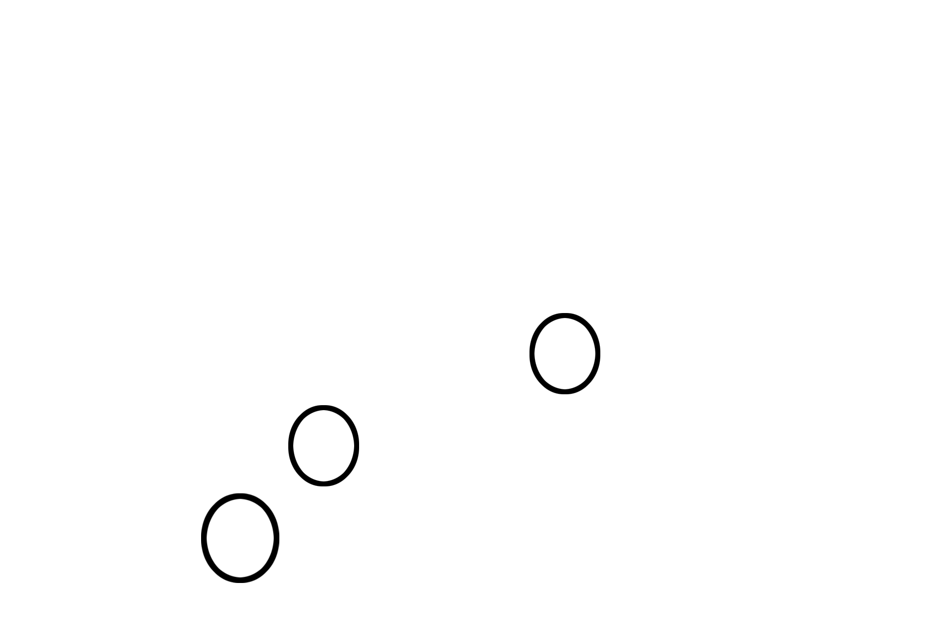  - Lymphoid nodules <p>The white pulp surrounds arterioles after they leave the trabeculae.  White pulp consists of both diffuse (T-dependent) and nodular (B-dependent) lymphoid tissues.  The diffuse tissue forms a sleeve around each arteriole, called the periarterial lymphoid sheath (PALS).  The lymphoid nodules are suspended within these diffuse areas of red pulp.</p>
