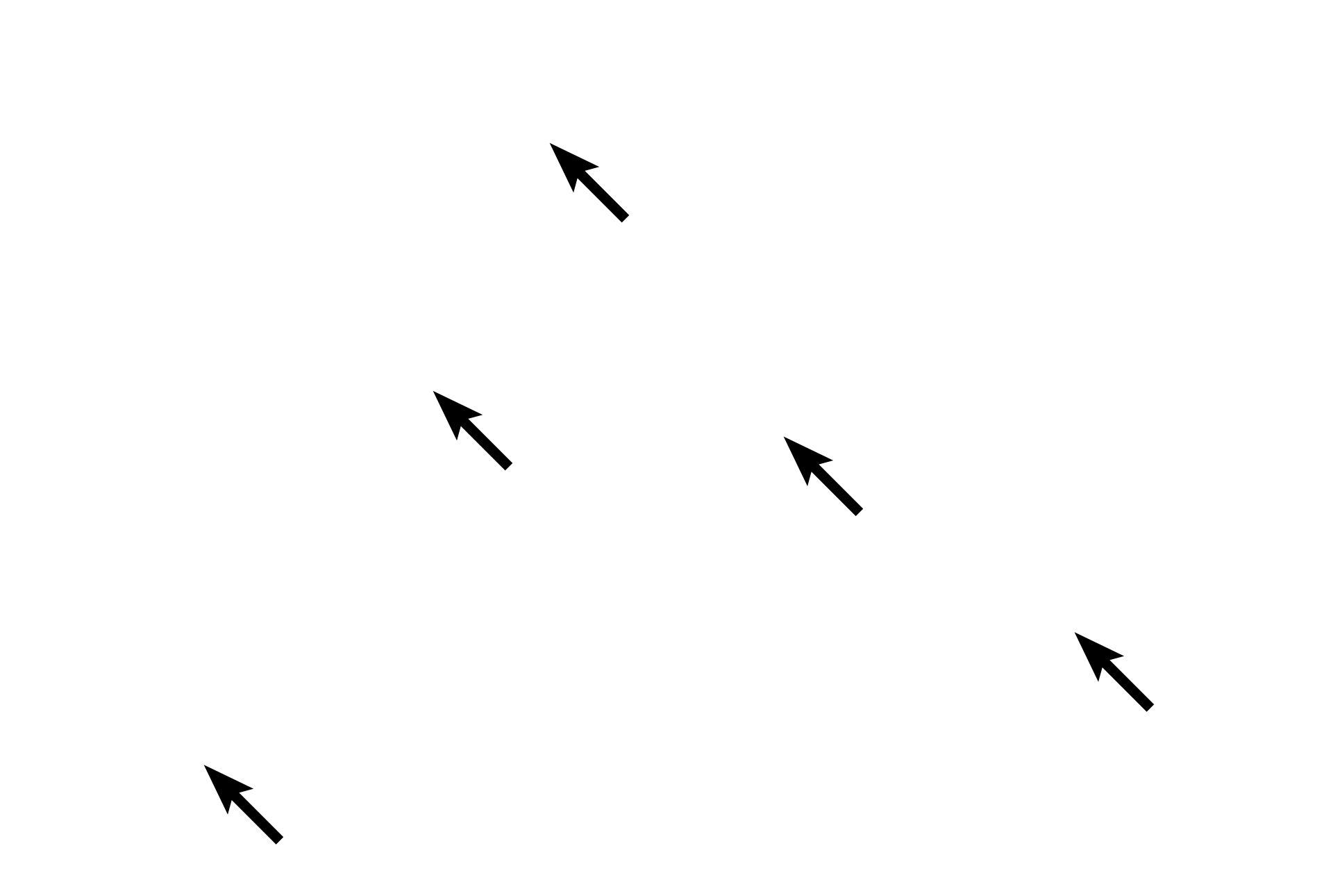  - Veins in red pulp <p>The red pulp consists of splenic cords (of Billroth) and splenic sinuses.  Splenic cords are composed of a variety of lymphatic cells supported by reticular connective tissue.  The sinuses are vascular channels between the splenic cords.  Because of the large number of these vascular sinuses, red pulp appears red in fresh tissue.</p>
