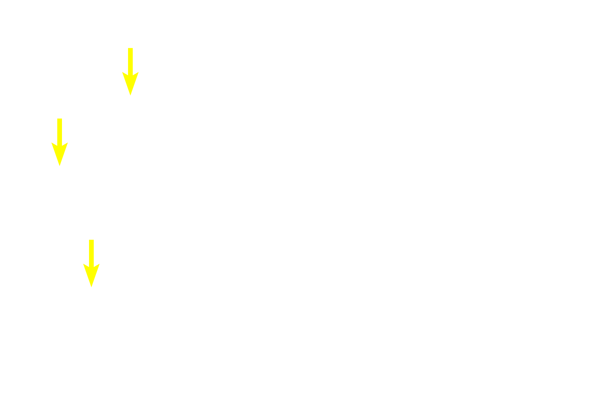 Capillaries in cords <p>The path by which blood enters splenic sinuses varies according to species.  Blood may flow directly into the sinuses from the capillaries (closed circulation) or the capillaries may open into the red pulp where the blood would percolate through the pulp before entering the sinuses (open circulation).  Open circulation is thought to predominate in the human.</p>
