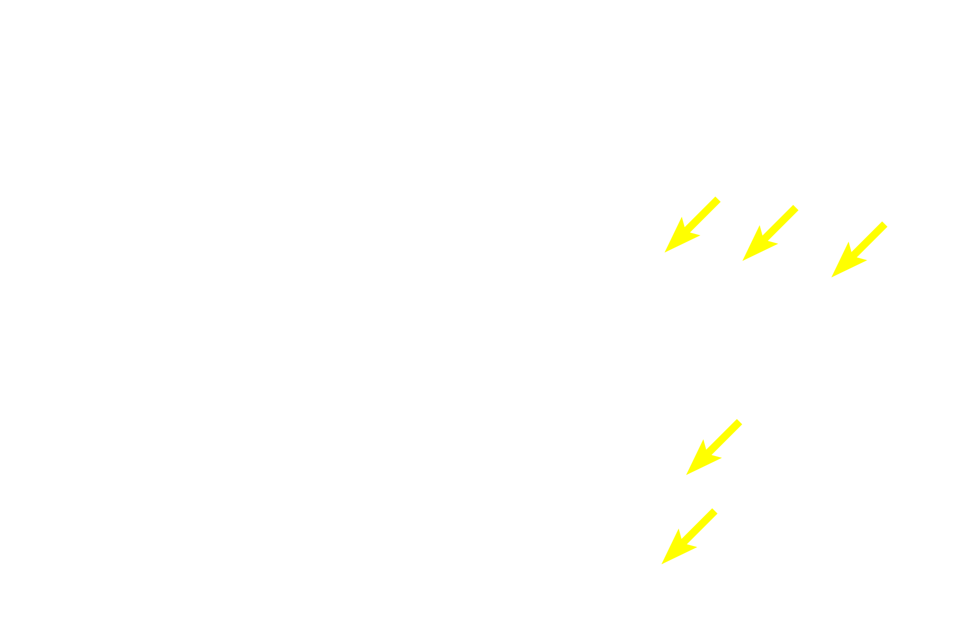 Endothelial discontinuities <p>The path by which blood enters splenic sinuses varies according to species.  Blood may flow directly into the sinuses from the capillaries (closed circulation) or the capillaries may open into the red pulp where the blood would percolate through the pulp before entering the sinuses (open circulation).  Open circulation is thought to predominate in the human.</p>
