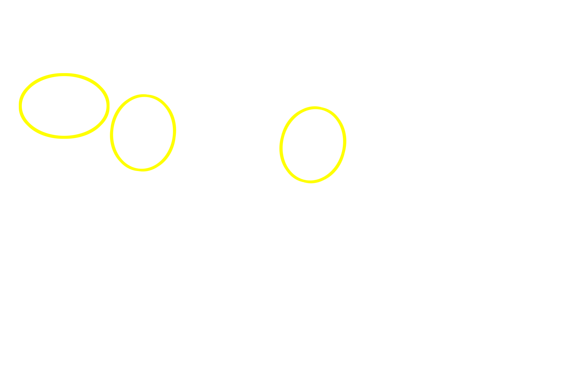 Lymphoid nodules <p>Along the course of the PALS, nodules develop within the PALS in response to B-cell activation.  These nodules resemble secondary nodules seen in other lymphatic tissues, including the presence of pale-staining, germinal centers resulting from B cell proliferation.  Their growth displaces the central arteriole to an eccentric position. The darker staining, T-dependent region of the PALS surrounds the germinal center.</p>
