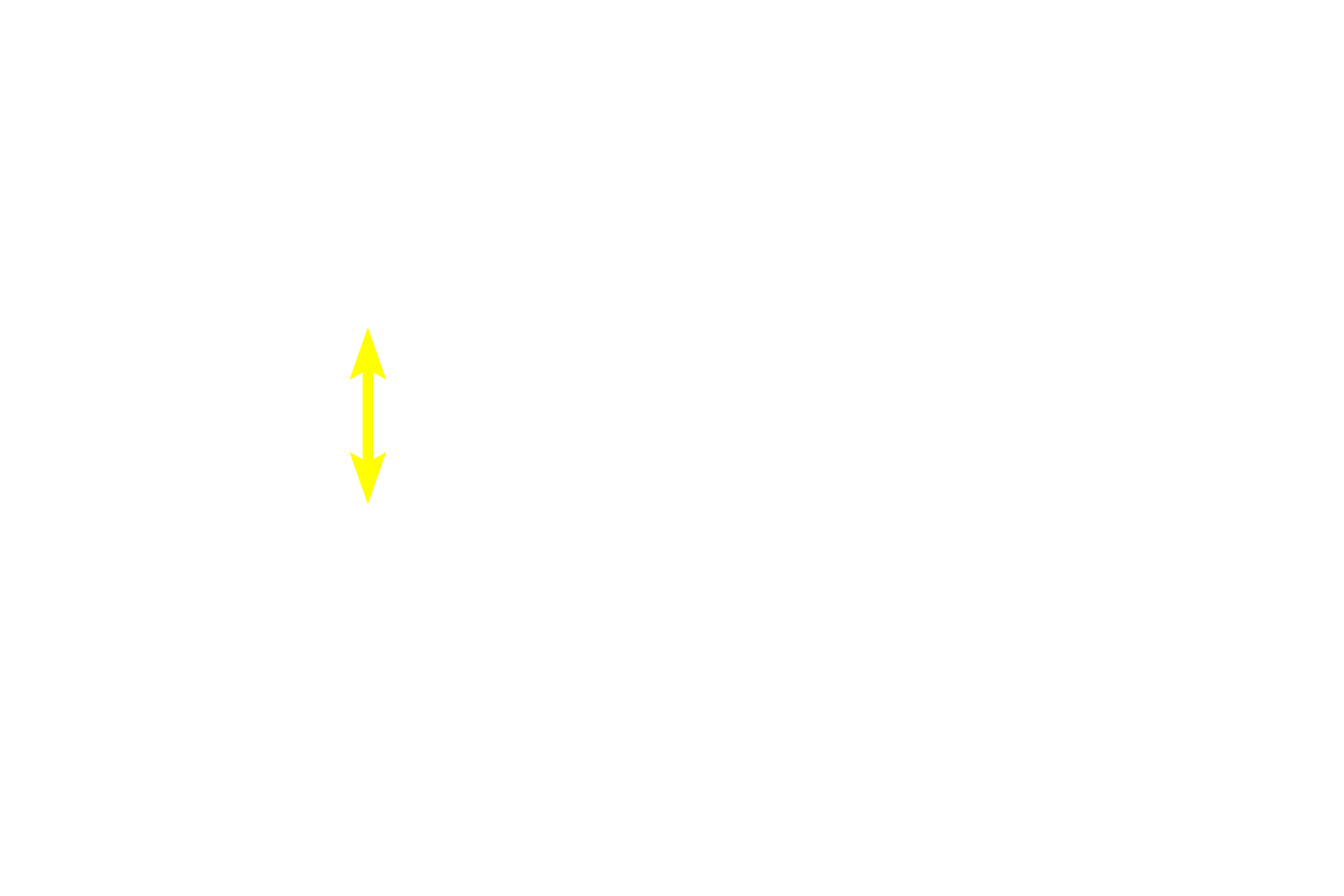 Germinal center <p>The central arteriole and its relationship to the PALS is seen at higher magnification (area indicated by the yellow frame in the inset).  For most of its course, the central arteriole is surrounded by PALS.  Frequently, lymphoid nodules, B-dependent areas that form part of white pulp, develop within the PALS, causing the central arteriole to be eccentrically located.  A germinal center is just beginning to form.  200x</p>
