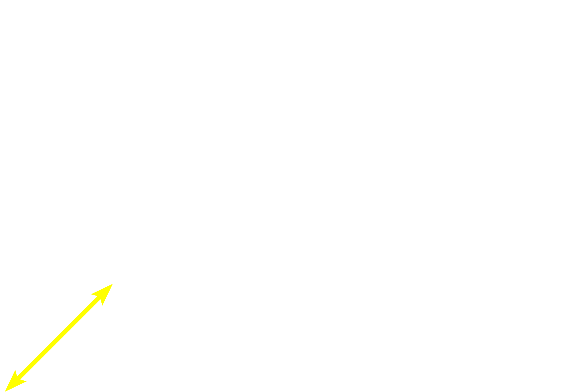 Red pulp <p>The central arteriole and its relationship to the PALS is seen at higher magnification (area indicated by the yellow frame in the inset).  For most of its course, the central arteriole is surrounded by PALS.  Frequently, lymphoid nodules, B-dependent areas that form part of white pulp, develop within the PALS, causing the central arteriole to be eccentrically located.  A germinal center is just beginning to form.  200x</p>

